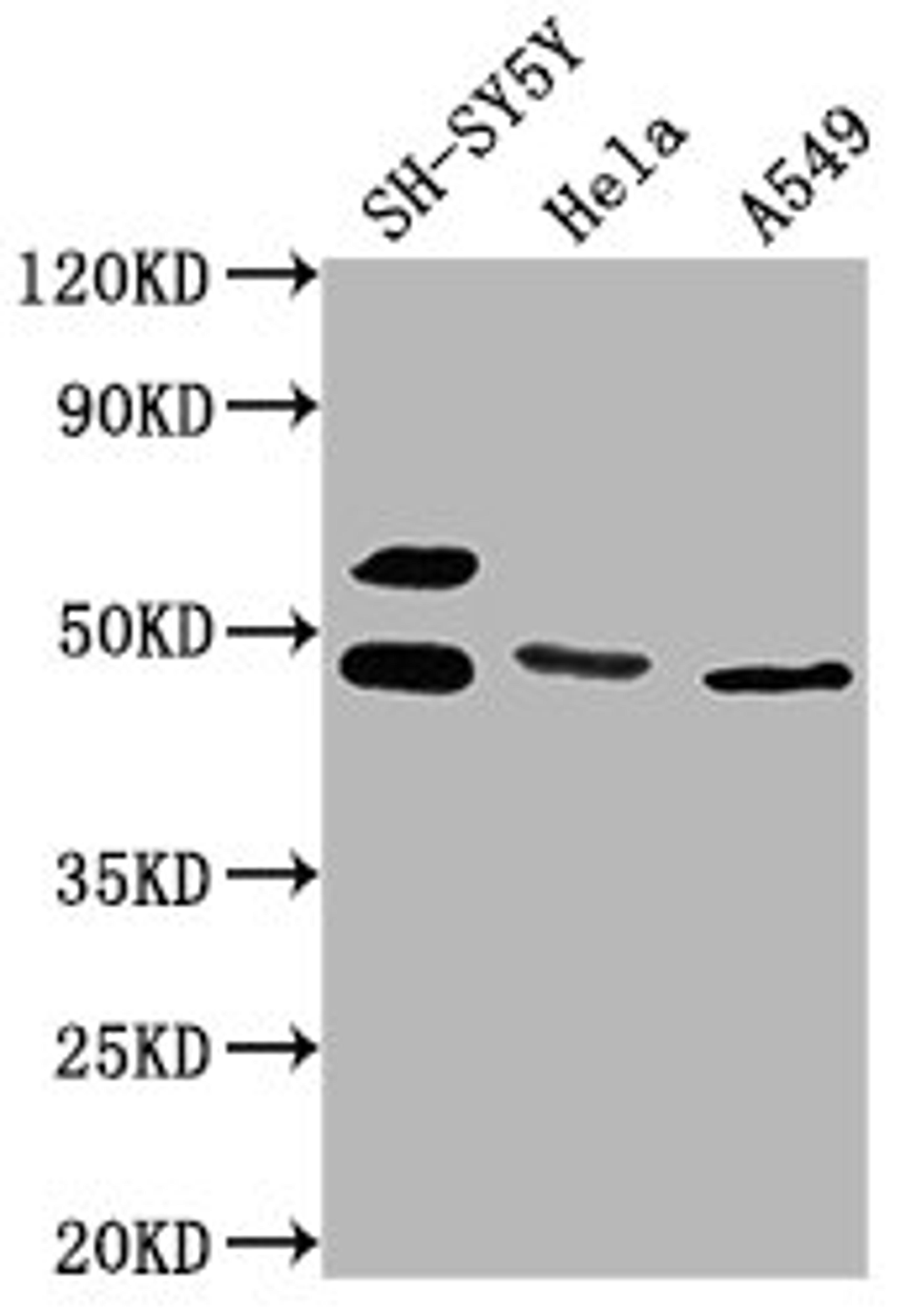 Western Blot. Positive WB detected in: SH-SY5Y whole cell lysate, Hela whole cell lysate, A549 whole cell lysate. All lanes: ANGPTL4 antibody at 1:1000. Secondary. Goat polyclonal to rabbit IgG at 1/50000 dilution. Predicted band size: 46, 41, 27 kDa. Observed band size: 46 kDa. 