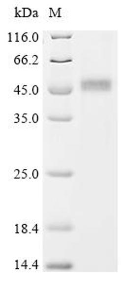 (Tris-Glycine gel) Discontinuous SDS-PAGE (reduced) with 5% enrichment gel and 15% separation gel.