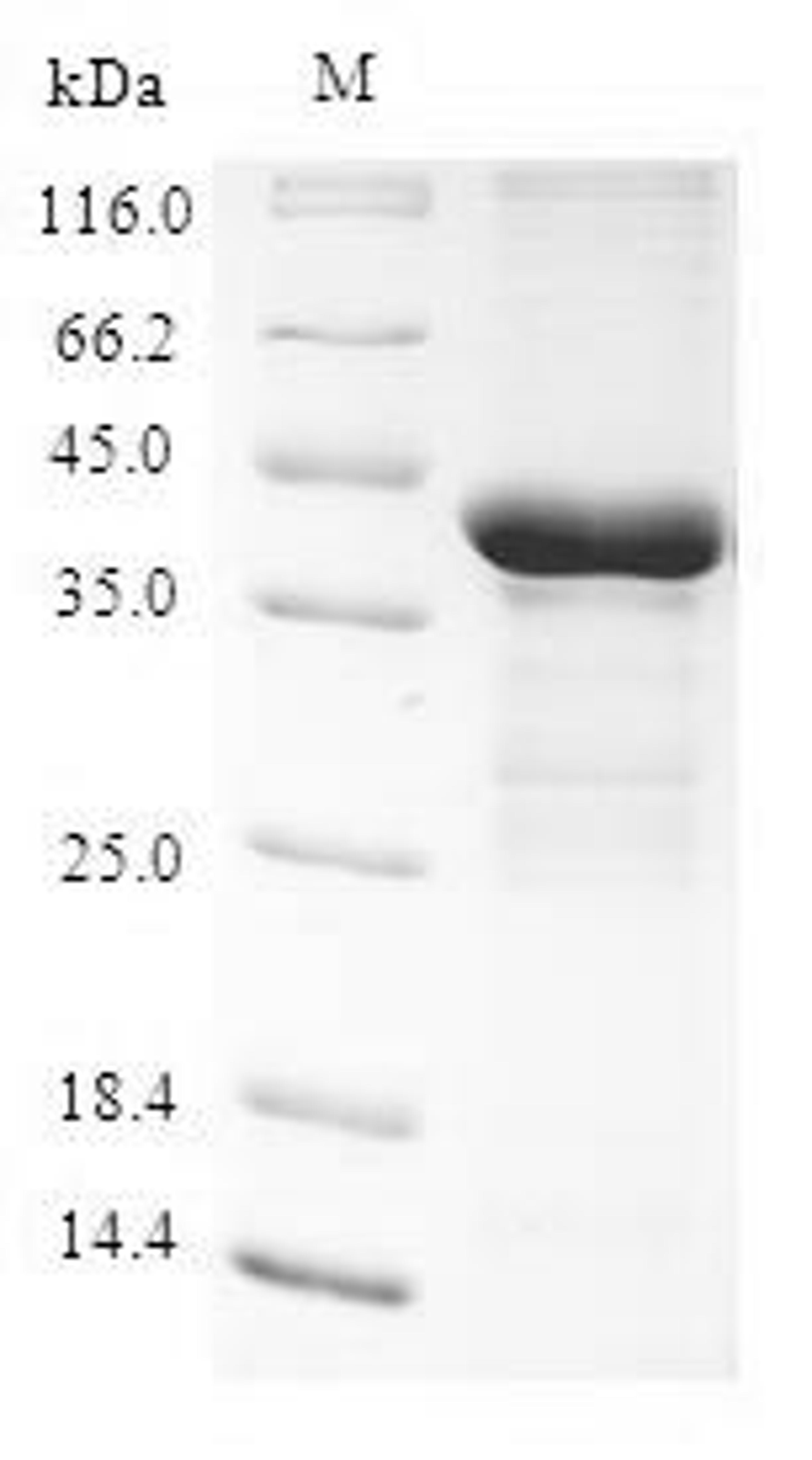 (Tris-Glycine gel) Discontinuous SDS-PAGE (reduced) with 5% enrichment gel and 15% separation gel.