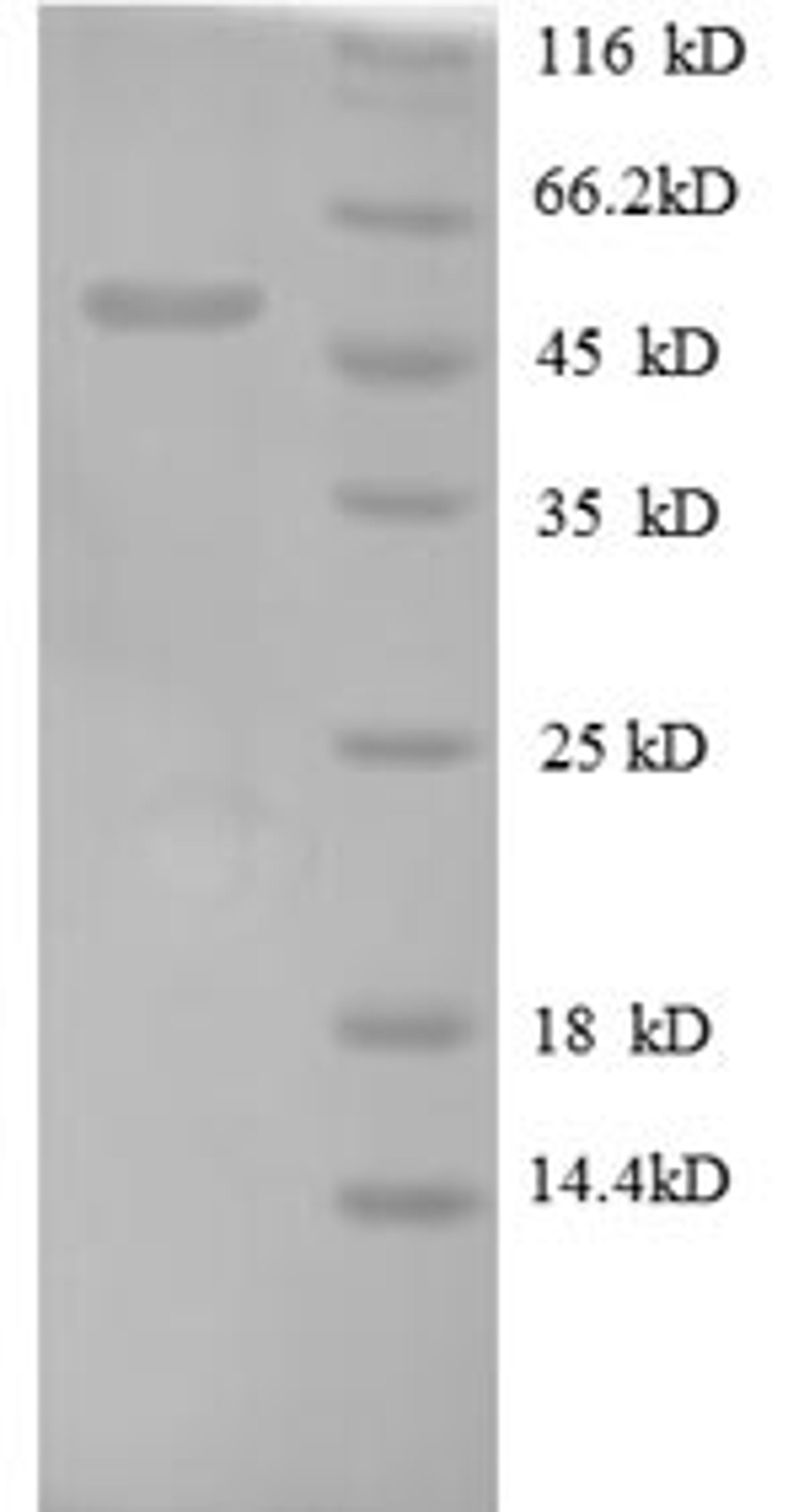 (Tris-Glycine gel) Discontinuous SDS-PAGE (reduced) with 5% enrichment gel and 15% separation gel.