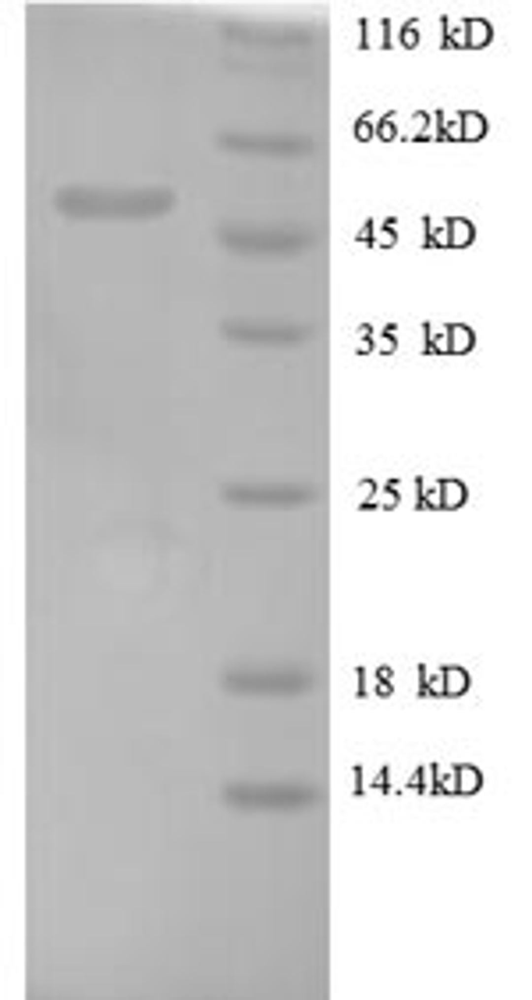 (Tris-Glycine gel) Discontinuous SDS-PAGE (reduced) with 5% enrichment gel and 15% separation gel.