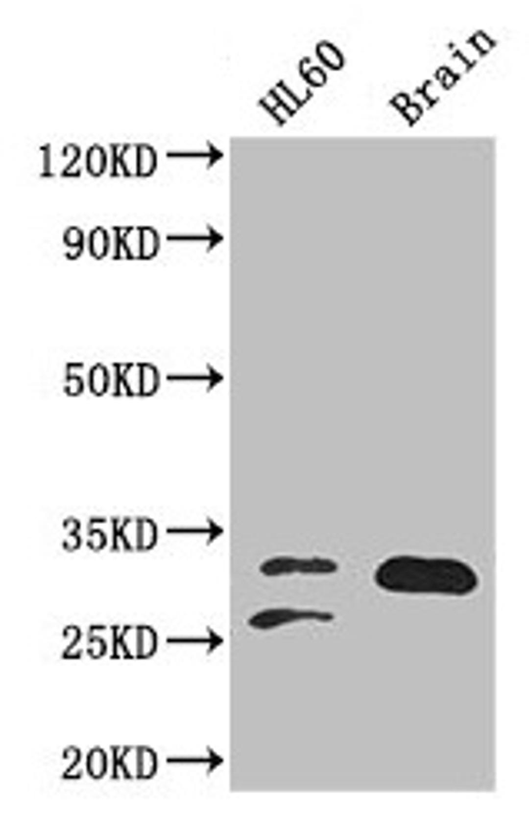 Western Blot. Positive WB detected in: HL60 whole cell lysate, Mouse brain tissue. All lanes: TPI1 antibody at 2µg/ml. Secondary. Goat polyclonal to rabbit IgG at 1/50000 dilution. Predicted band size: 31, 27, 18 kDa. Observed band size: 31, 27 kDa