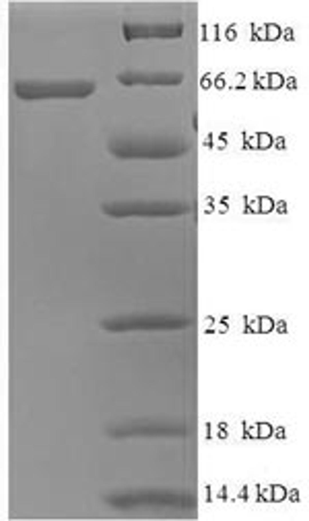 (Tris-Glycine gel) Discontinuous SDS-PAGE (reduced) with 5% enrichment gel and 15% separation gel.