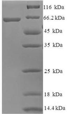 (Tris-Glycine gel) Discontinuous SDS-PAGE (reduced) with 5% enrichment gel and 15% separation gel.