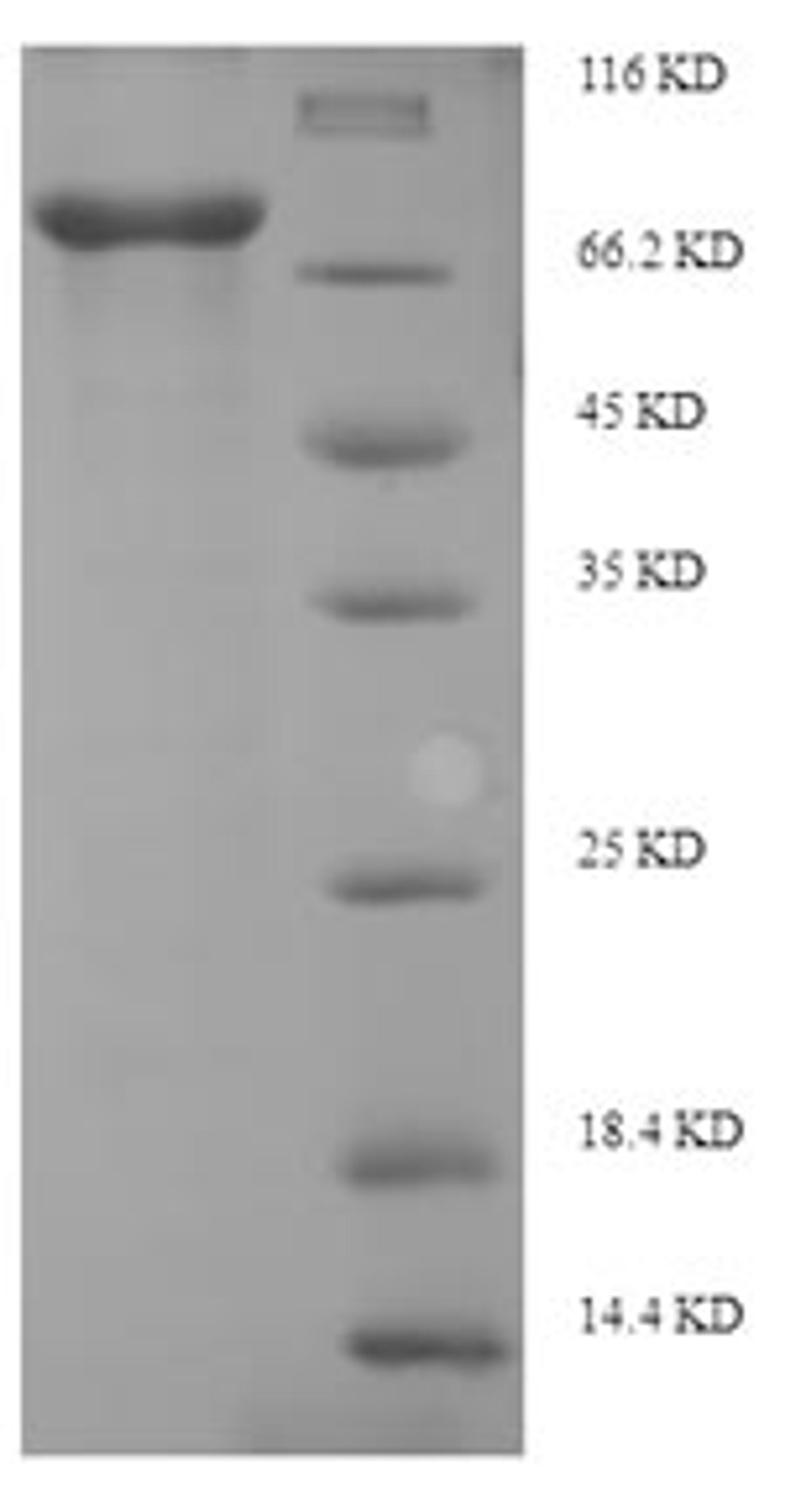 (Tris-Glycine gel) Discontinuous SDS-PAGE (reduced) with 5% enrichment gel and 15% separation gel.
