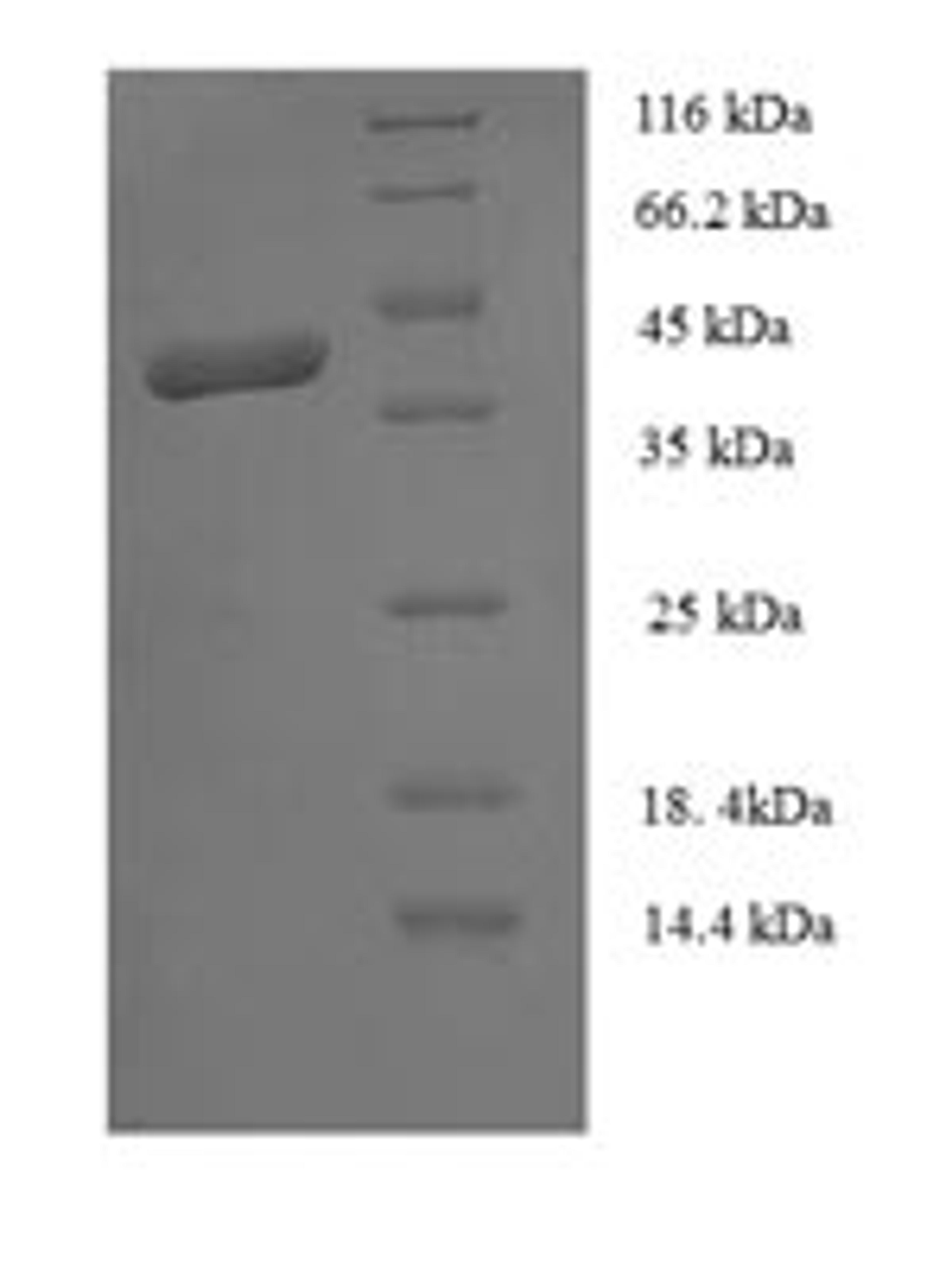 (Tris-Glycine gel) Discontinuous SDS-PAGE (reduced) with 5% enrichment gel and 15% separation gel.