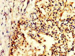 IHC image of CSB-PA614884LA01HU diluted at 1:200 and staining in paraffin-embedded human lung tissue performed on a Leica BondTM system. After dewaxing and hydration, antigen retrieval was mediated by high pressure in a citrate buffer (pH 6.0). Section was blocked with 10% normal goat serum 30min at RT. Then primary antibody (1% BSA) was incubated at 4&deg;C overnight. The primary is detected by a biotinylated secondary antibody and visualized using an HRP conjugated SP system.