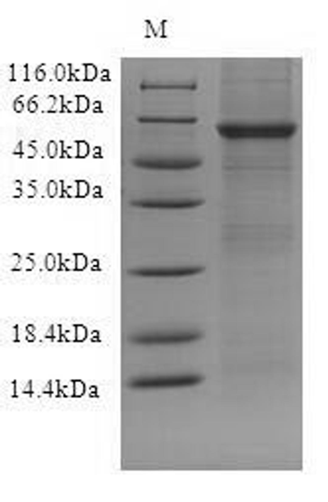 (Tris-Glycine gel) Discontinuous SDS-PAGE (reduced) with 5% enrichment gel and 15% separation gel.