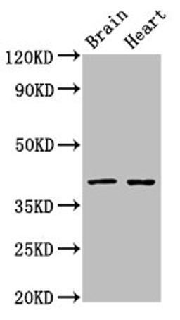 Western Blot. Positive WB detected in: Rat brain tissue, Rat heart tissue. All lanes: CERS1 antibody at 3ug/ml. Secondary. Goat polyclonal to rabbit IgG at 1/50000 dilution. Predicted band size: 40, 38 kDa. Observed band size: 40 kDa. 