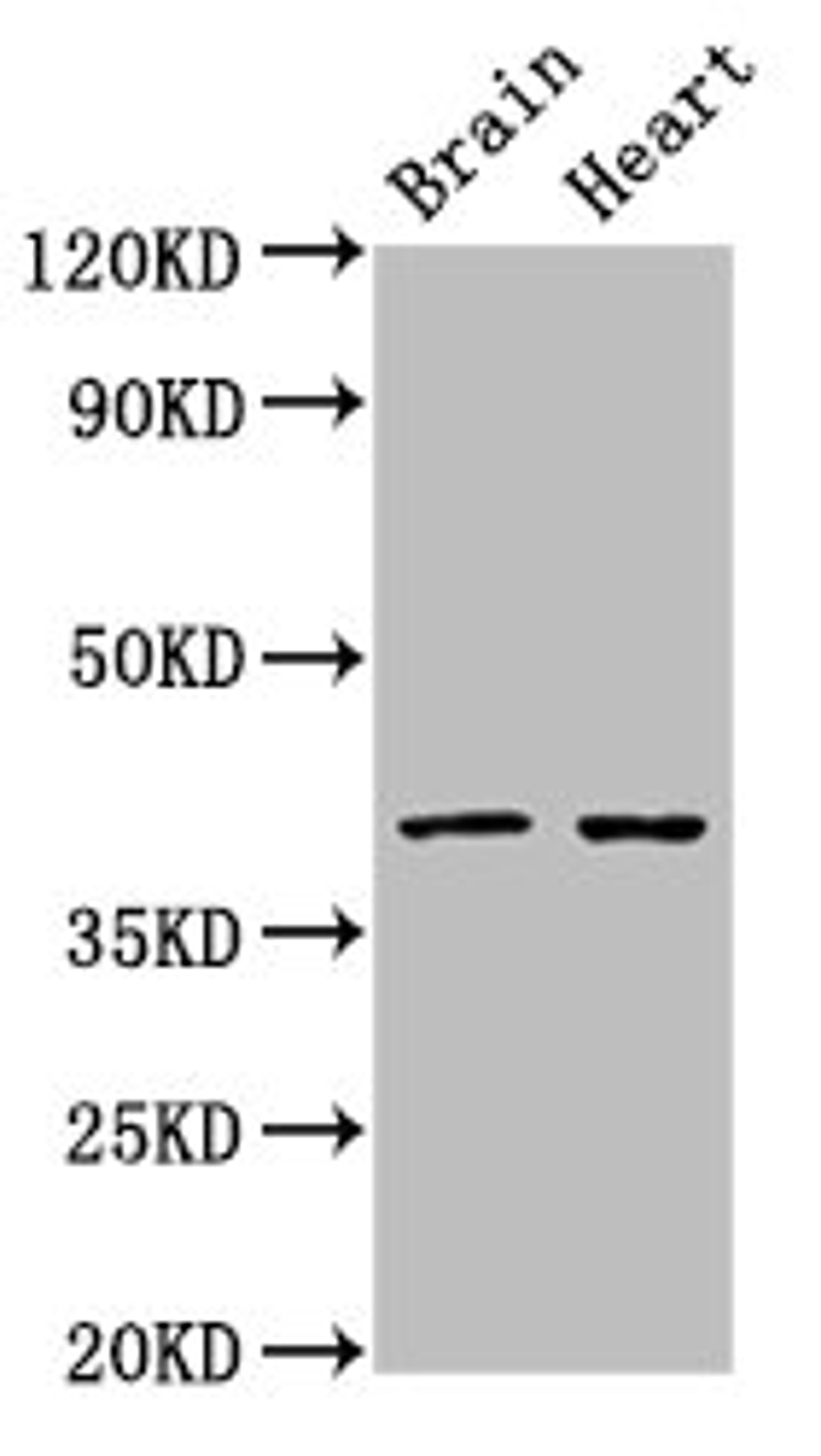 Western Blot. Positive WB detected in: Rat brain tissue, Rat heart tissue. All lanes: CERS1 antibody at 3ug/ml. Secondary. Goat polyclonal to rabbit IgG at 1/50000 dilution. Predicted band size: 40, 38 kDa. Observed band size: 40 kDa. 