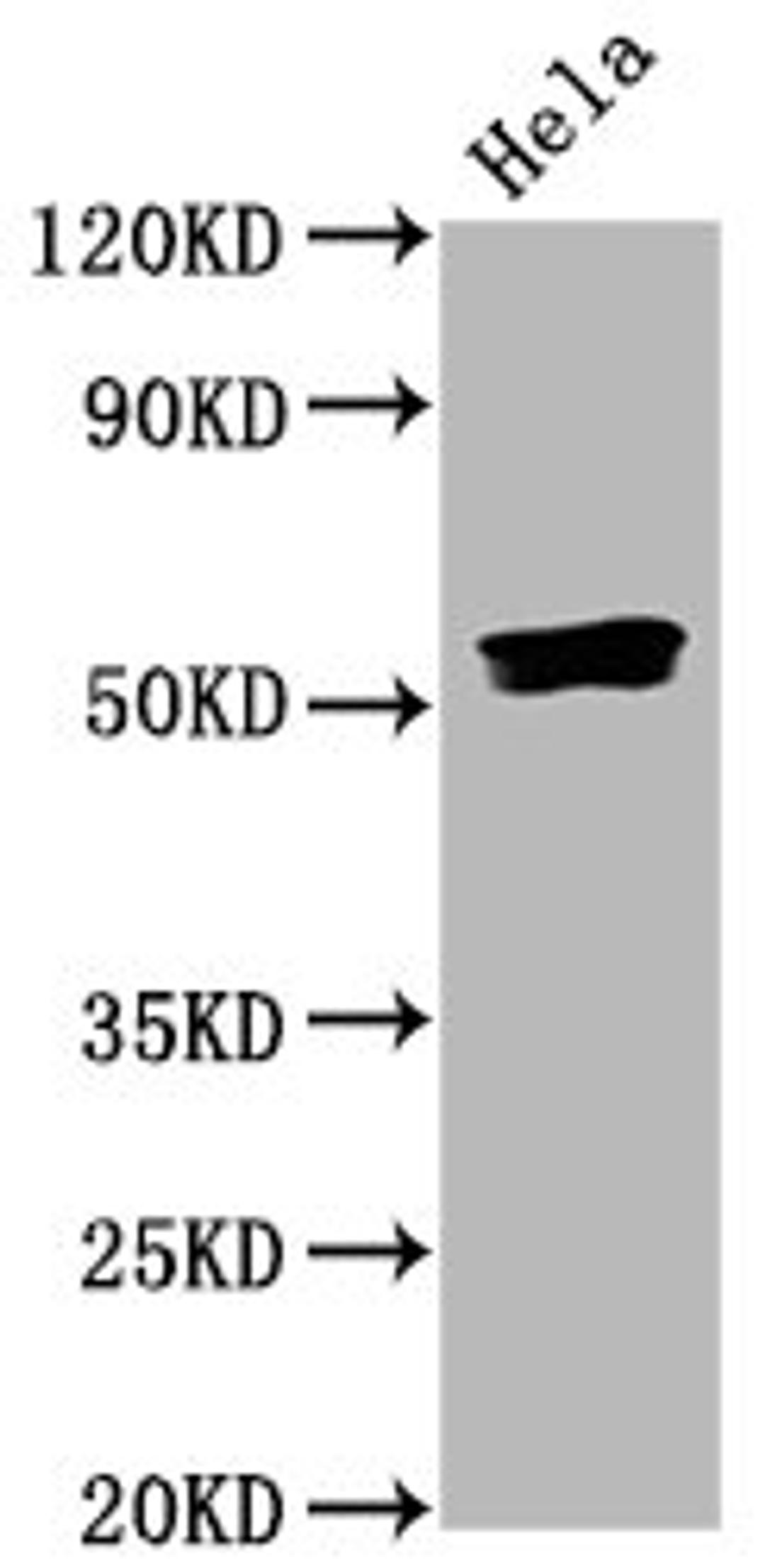 Western Blot. Positive WB detected in Hela whole cell lysate. All lanes Phospho-SMAD5 antibody at 0.835μg/ml. Secondary. Goat polyclonal to rabbit IgG at 1/50000 dilution. Predicted band size: 52 KDa. Observed band size: 52 KDa. 