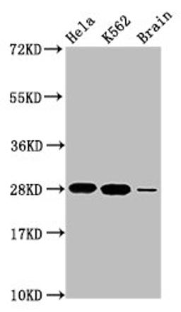 Western Blot. Positive WB detected in: Hela whole cell lysate, K562 whole cell lysate, Rat brain tissue. All lanes: HIST1H1E antibody at 1.48µg/ml. Secondary. Goat polyclonal to rabbit IgG at 1/50000 dilution. Predicted band size: 22 kDa. Observed band size: 28 kDa