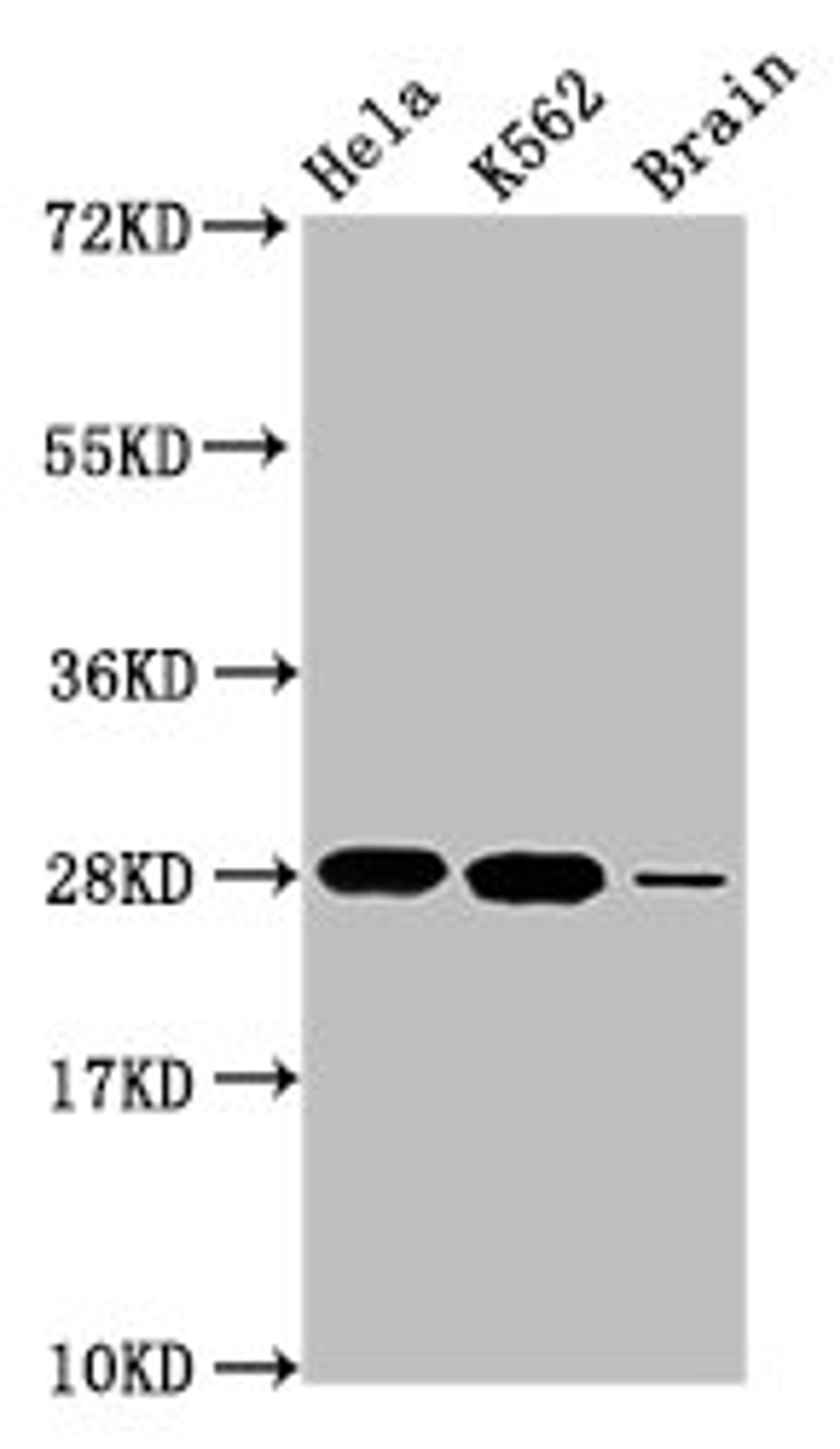 Western Blot. Positive WB detected in: Hela whole cell lysate, K562 whole cell lysate, Rat brain tissue. All lanes: HIST1H1E antibody at 1.48µg/ml. Secondary. Goat polyclonal to rabbit IgG at 1/50000 dilution. Predicted band size: 22 kDa. Observed band size: 28 kDa