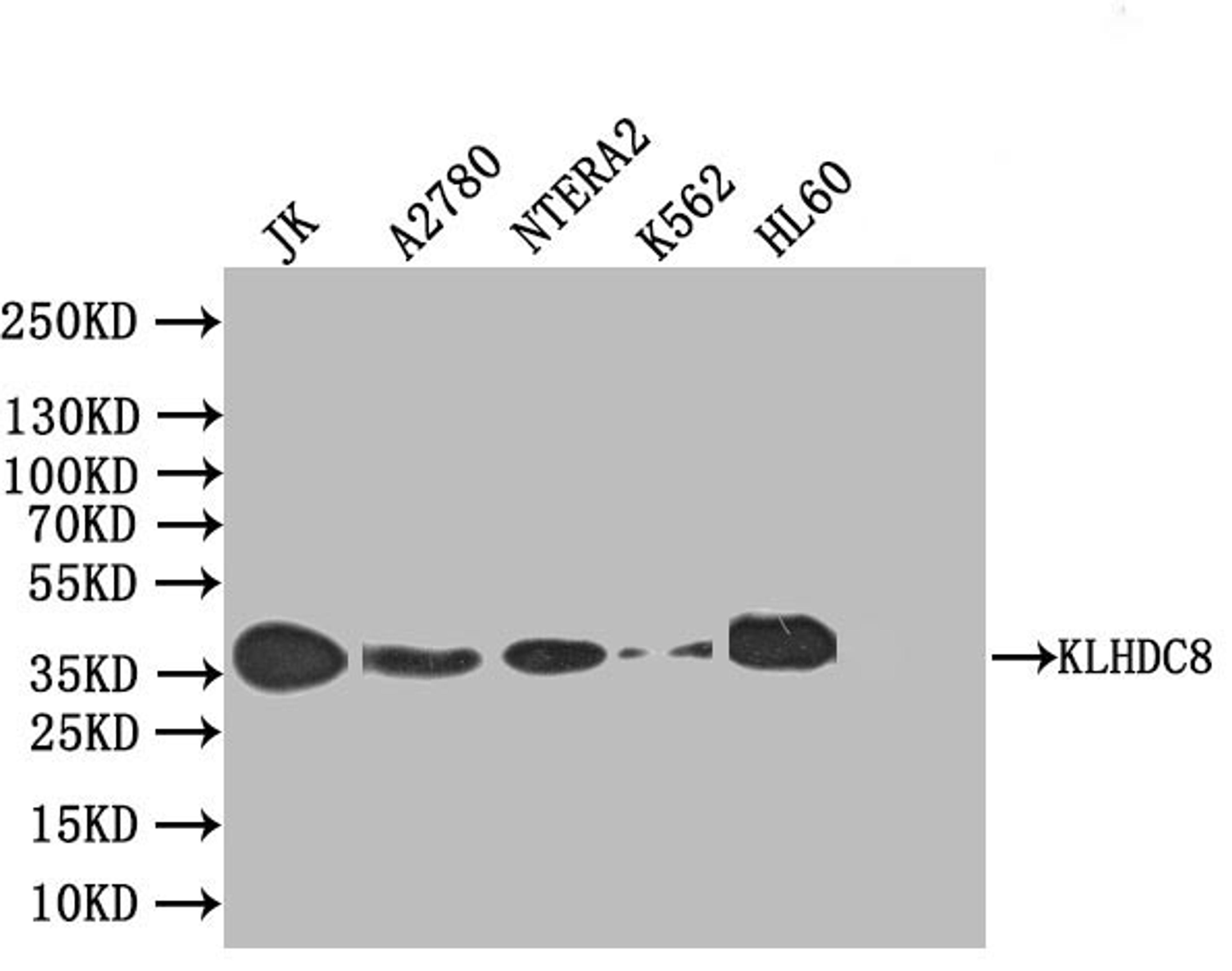 Western blot. All lanes: KLHDC8A antibody at 0.5µg/ml. Lane 1: Jurkat whole cell lysate. Lane 2: Mouse liver tissue. Secondary. Goat polyclonal to rabbit IgG at 1/10000 dilution. Predicted band size: 39 kDa. Observed band size: 39 kDa
