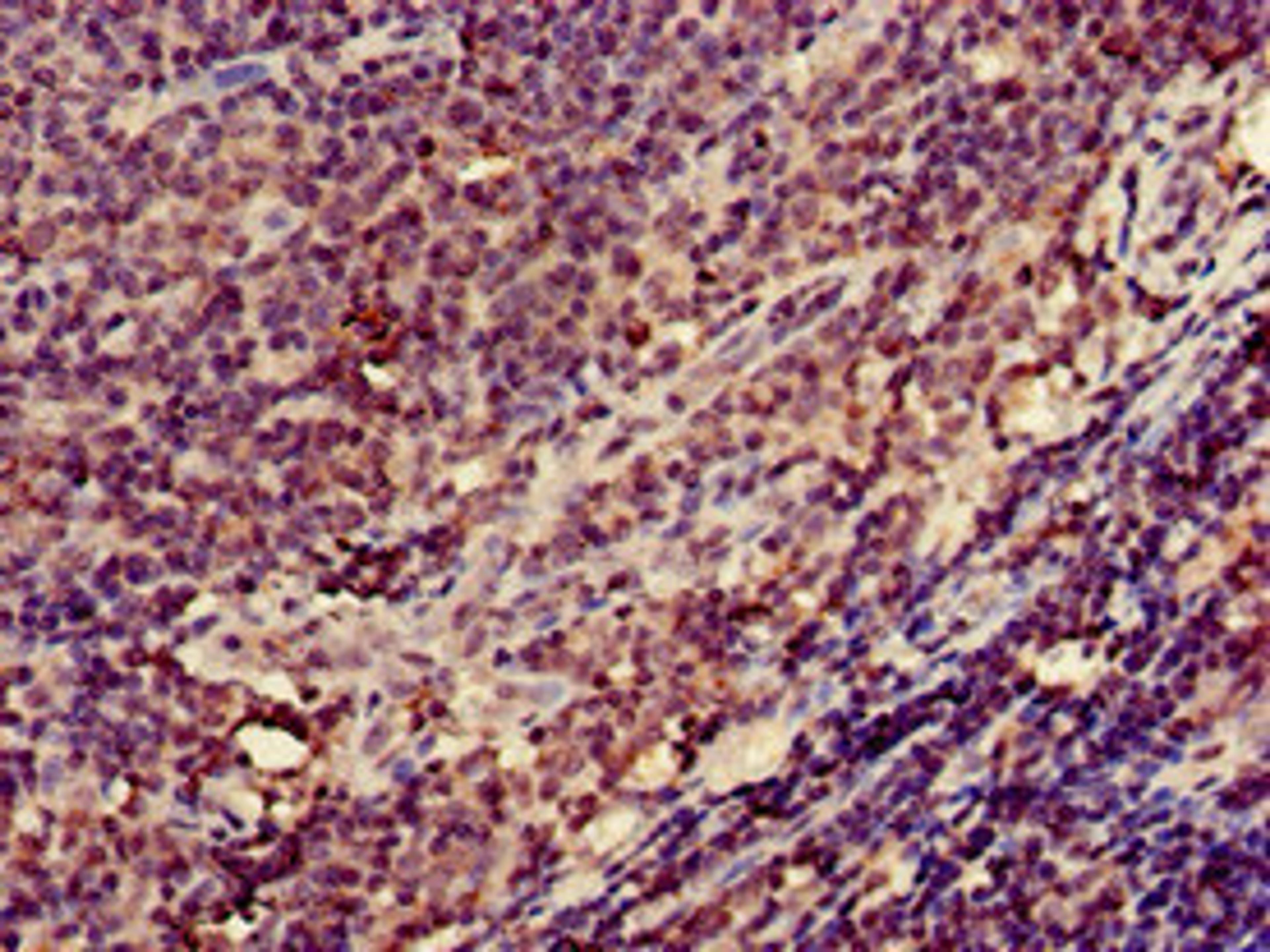 Immunohistochemistry of paraffin-embedded human lymph node tissue using CSB-PA011884LA01HU at dilution of 1:100