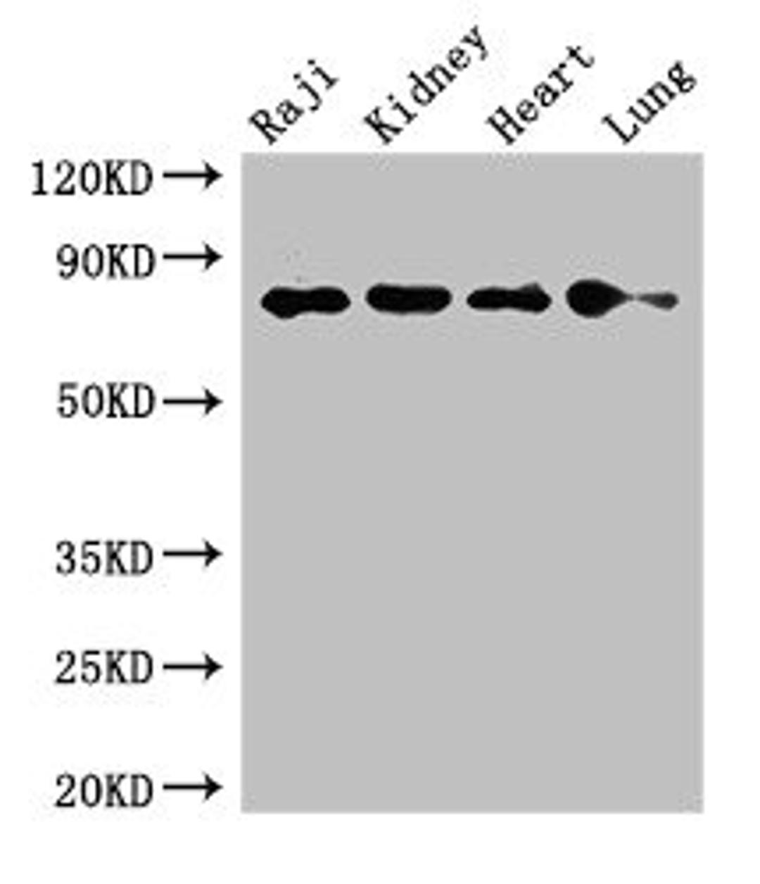 Western Blot. Positive WB detected in: Raji whole cell lysate, Mouse kidney tissue, Rat heart tissue, Rat lung tissue. All lanes: PECAM1 antibody at 2.7ug/ml. Secondary. Goat polyclonal to rabbit IgG at 1/50000 dilution. Predicted band size: 83, 81, 80, 82 kDa. Observed band size: 83 kDa. 