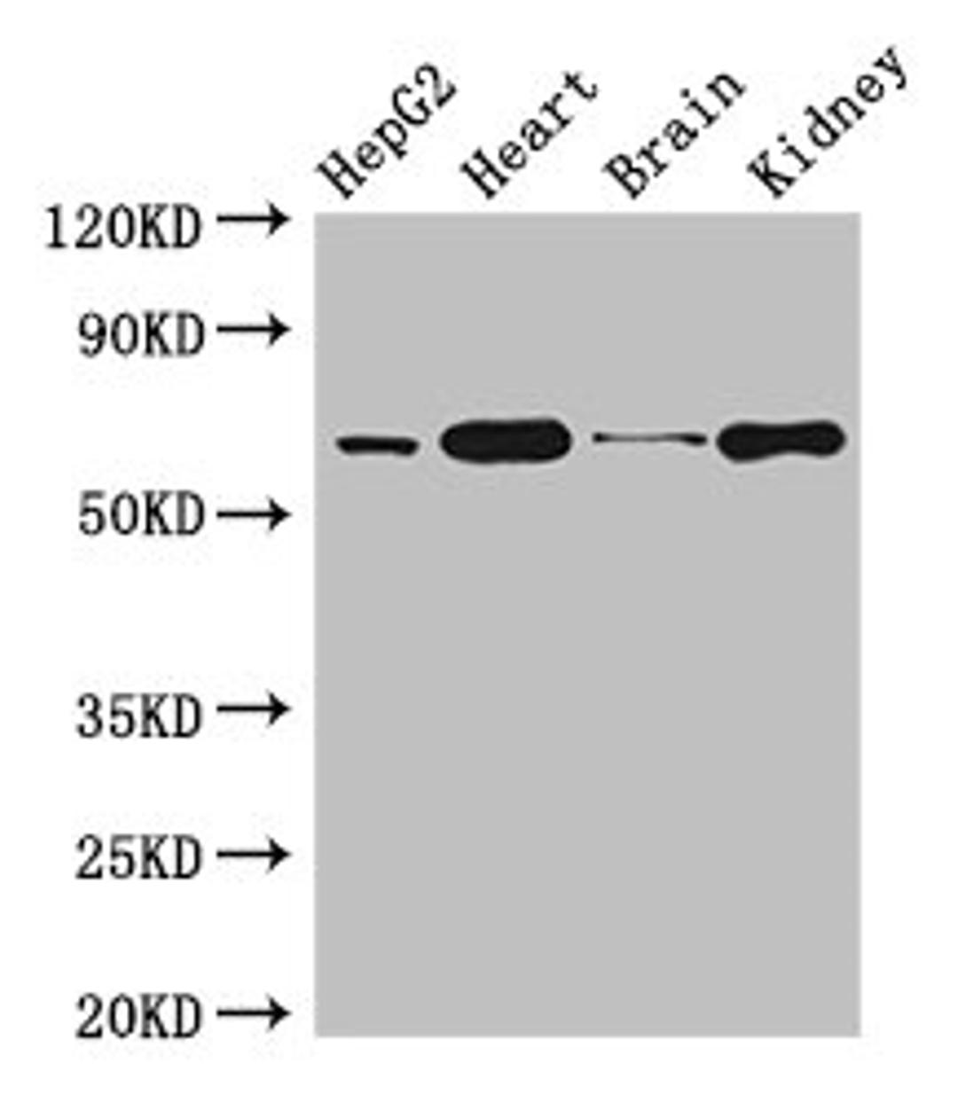 Western Blot. Positive WB detected in: HepG2 whole cell lysate, Mouse heart tissue, Mouse brain tissue, Mouse kidney tissue. All lanes: HNRNPL antibody at 3µg/ml. Secondary. Goat polyclonal to rabbit IgG at 1/50000 dilution. Predicted band size: 65, 51 kDa. Observed band size: 65 kDa