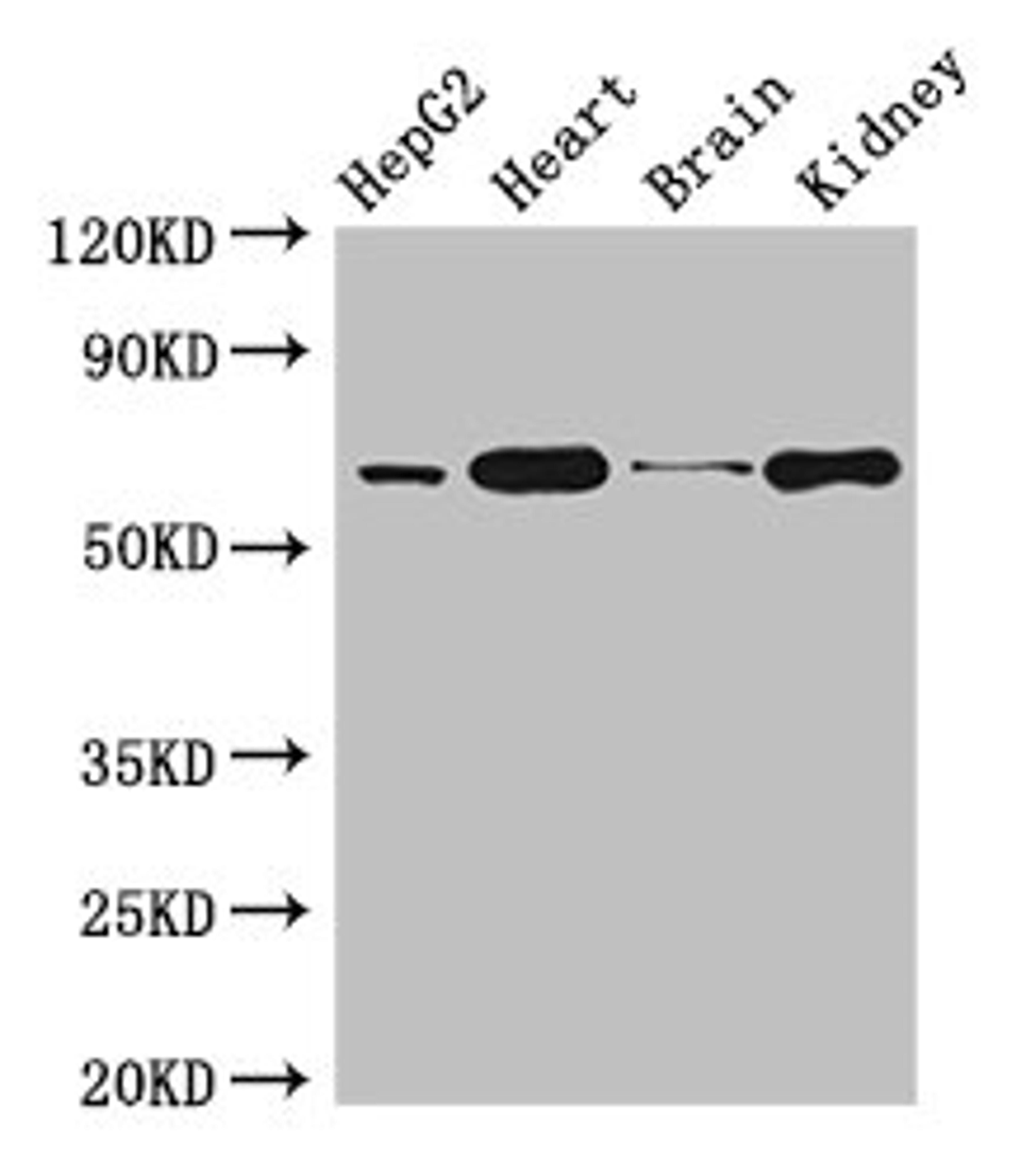 Western Blot. Positive WB detected in: HepG2 whole cell lysate, Mouse heart tissue, Mouse brain tissue, Mouse kidney tissue. All lanes: HNRNPL antibody at 3µg/ml. Secondary. Goat polyclonal to rabbit IgG at 1/50000 dilution. Predicted band size: 65, 51 kDa. Observed band size: 65 kDa