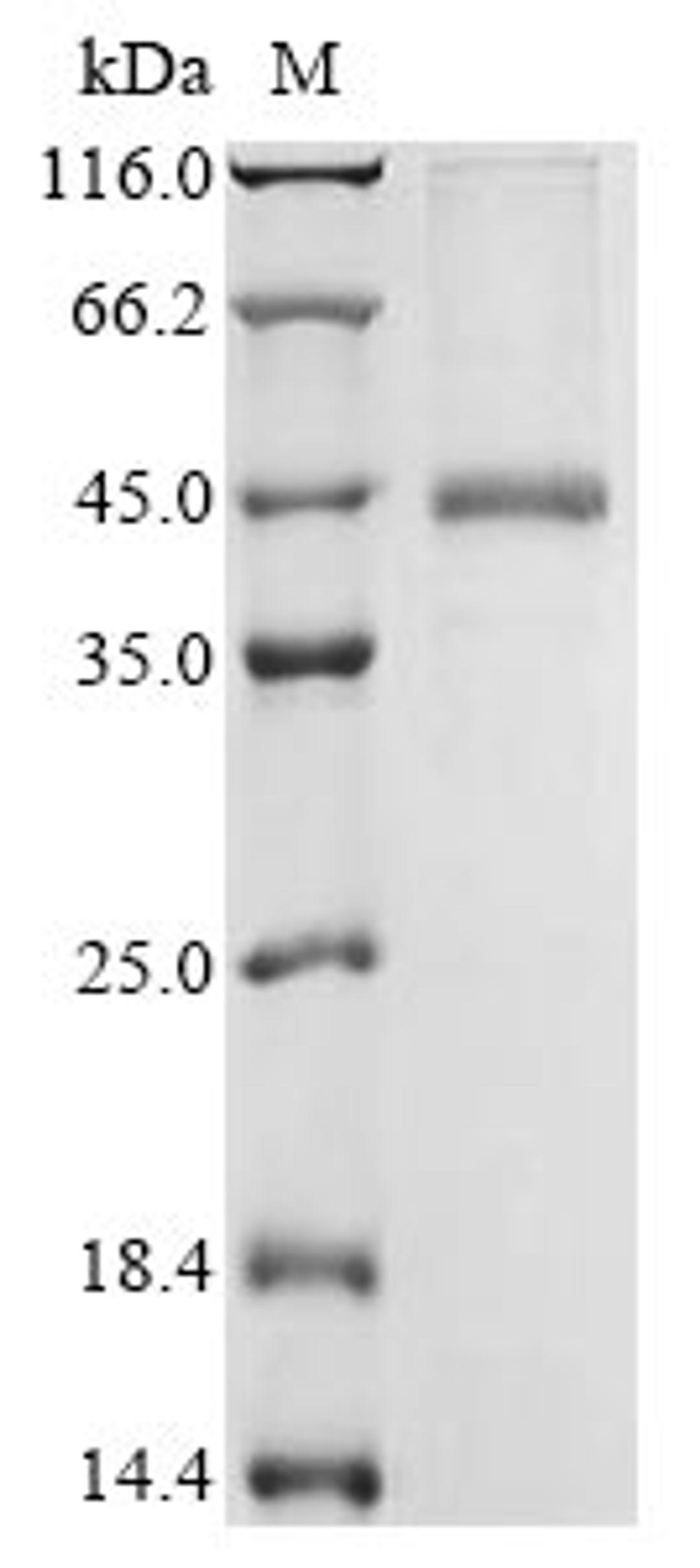 (Tris-Glycine gel) Discontinuous SDS-PAGE (reduced) with 5% enrichment gel and 15% separation gel.