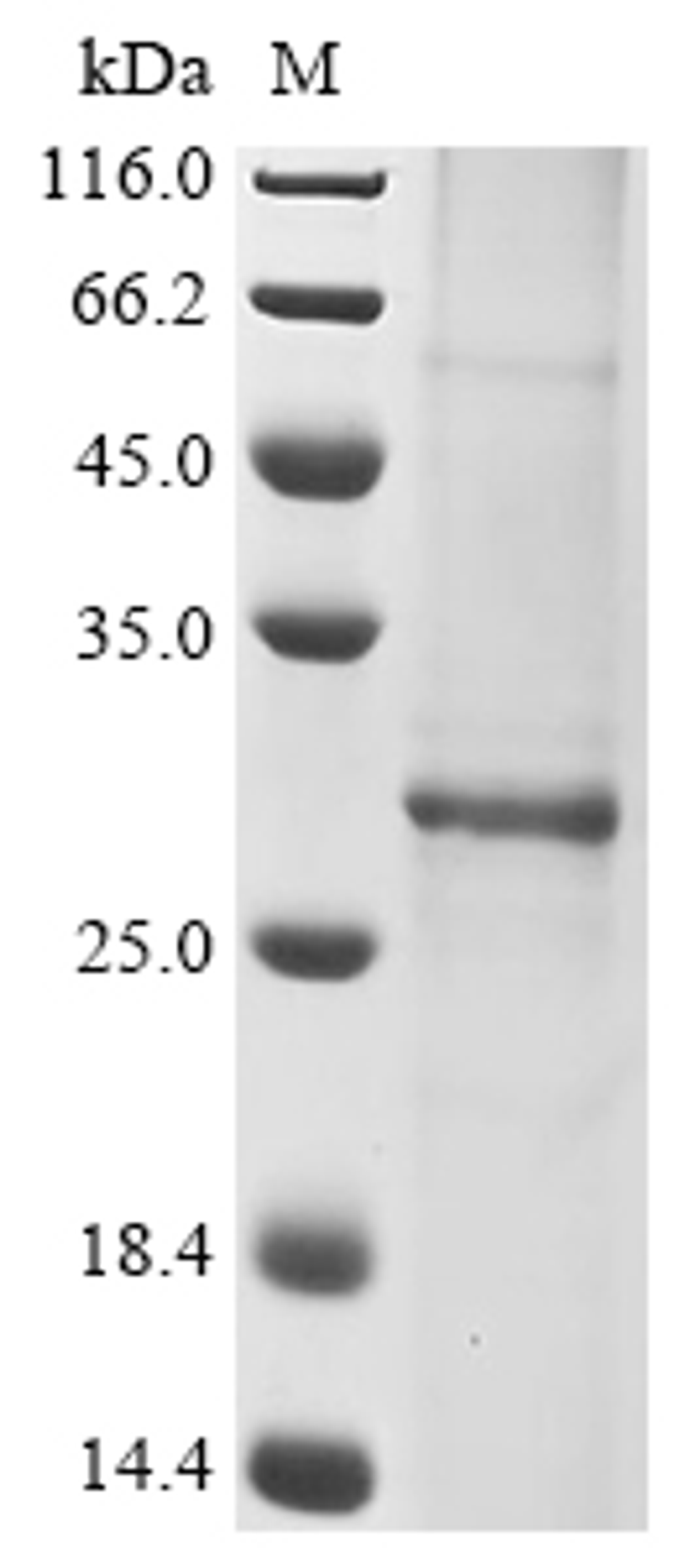 (Tris-Glycine gel) Discontinuous SDS-PAGE (reduced) with 5% enrichment gel and 15% separation gel.
