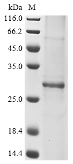 (Tris-Glycine gel) Discontinuous SDS-PAGE (reduced) with 5% enrichment gel and 15% separation gel.
