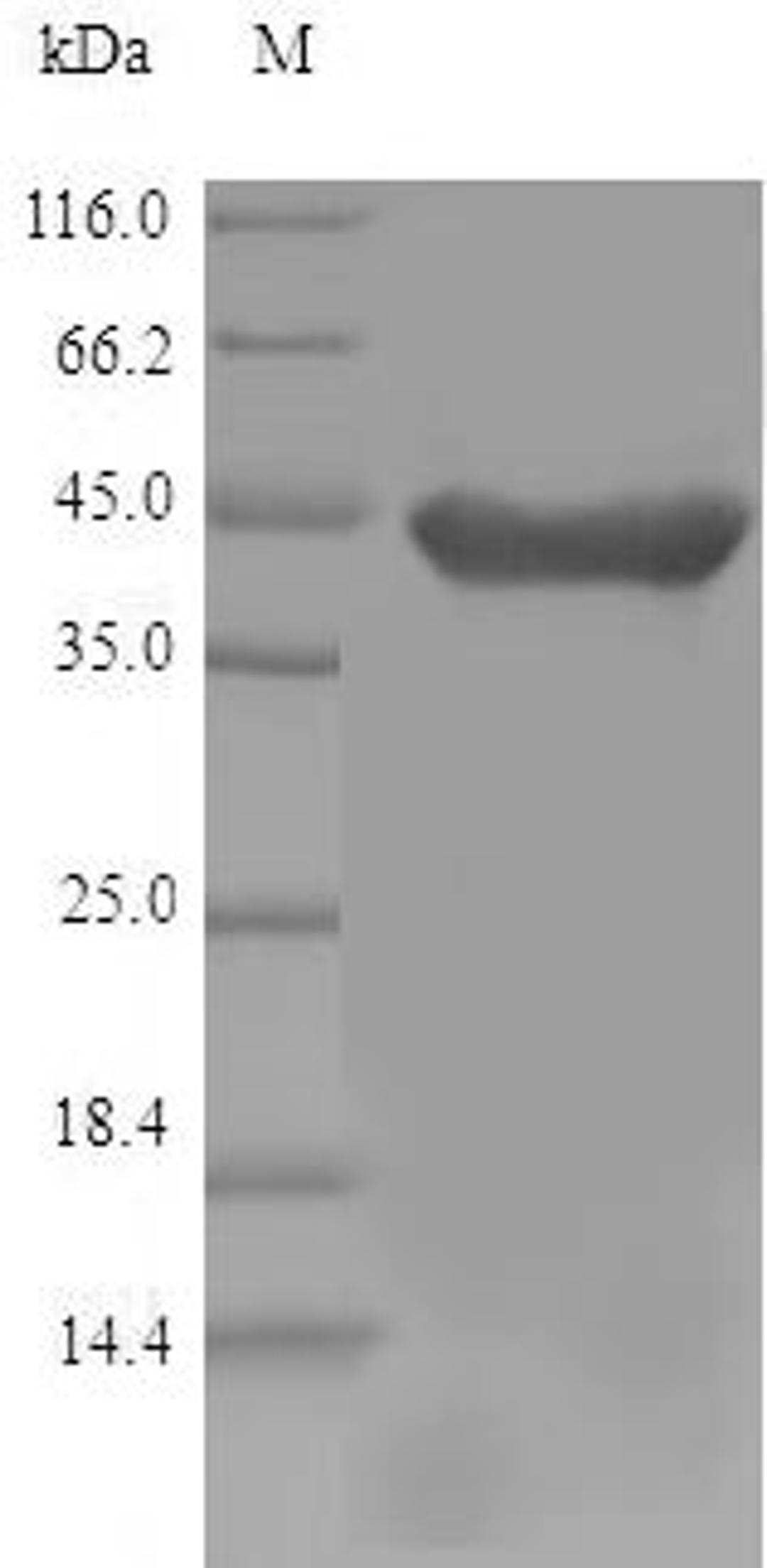 (Tris-Glycine gel) Discontinuous SDS-PAGE (reduced) with 5% enrichment gel and 15% separation gel.