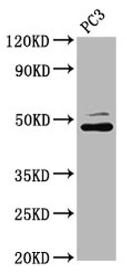 Western Blot. Positive WB detected in: PC-3 whole cell lysate. All lanes: SEC14L2 antibody at 4.28µg/ml. Secondary. Goat polyclonal to rabbit IgG at 1/50000 dilution. Predicted band size: 47, 45, 37 kDa. Observed band size: 47 kDa