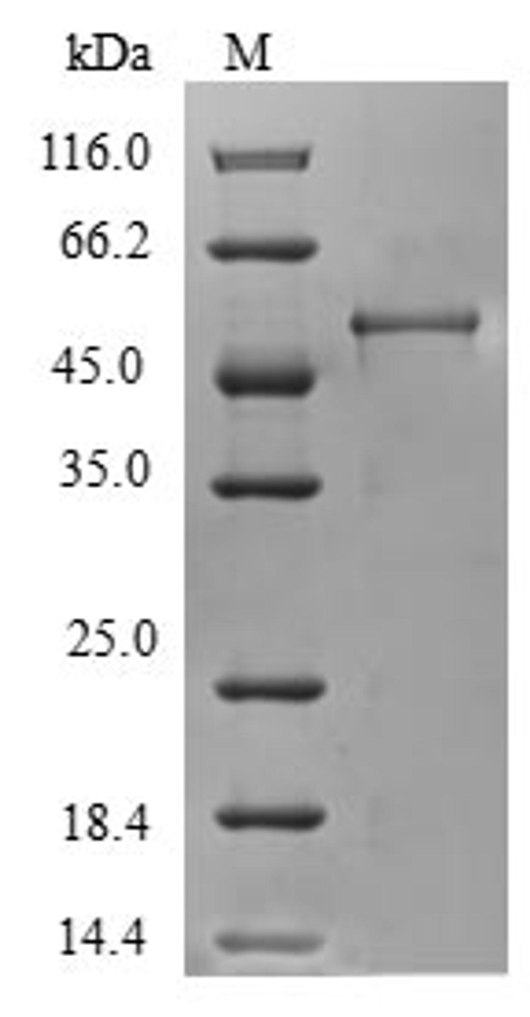 (Tris-Glycine gel) Discontinuous SDS-PAGE (reduced) with 5% enrichment gel and 15% separation gel.