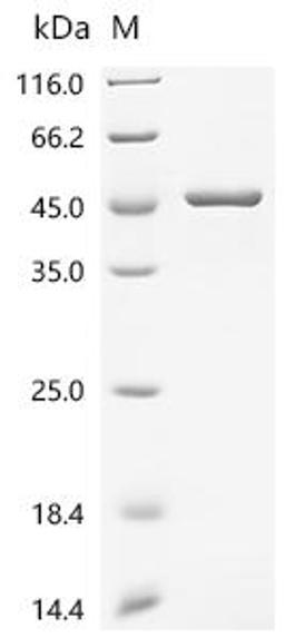 (Tris-Glycine gel) Discontinuous SDS-PAGE (reduced) with 5% enrichment gel and 15% separation gel.