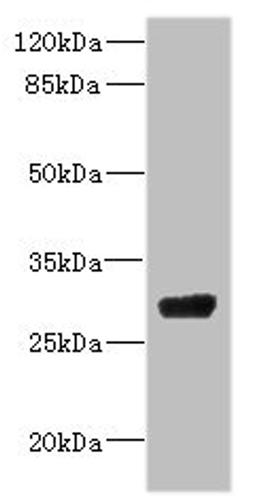 Western blot. All lanes: CPSF4 antibody IgG at 4.37ug/ml + 293T whole cell lysate. Secondary. Goat polyclonal to rabbit IgG at 1/10000 dilution. Predicted band size: 31, 28 kDa. Observed band size: 31 kDa. 