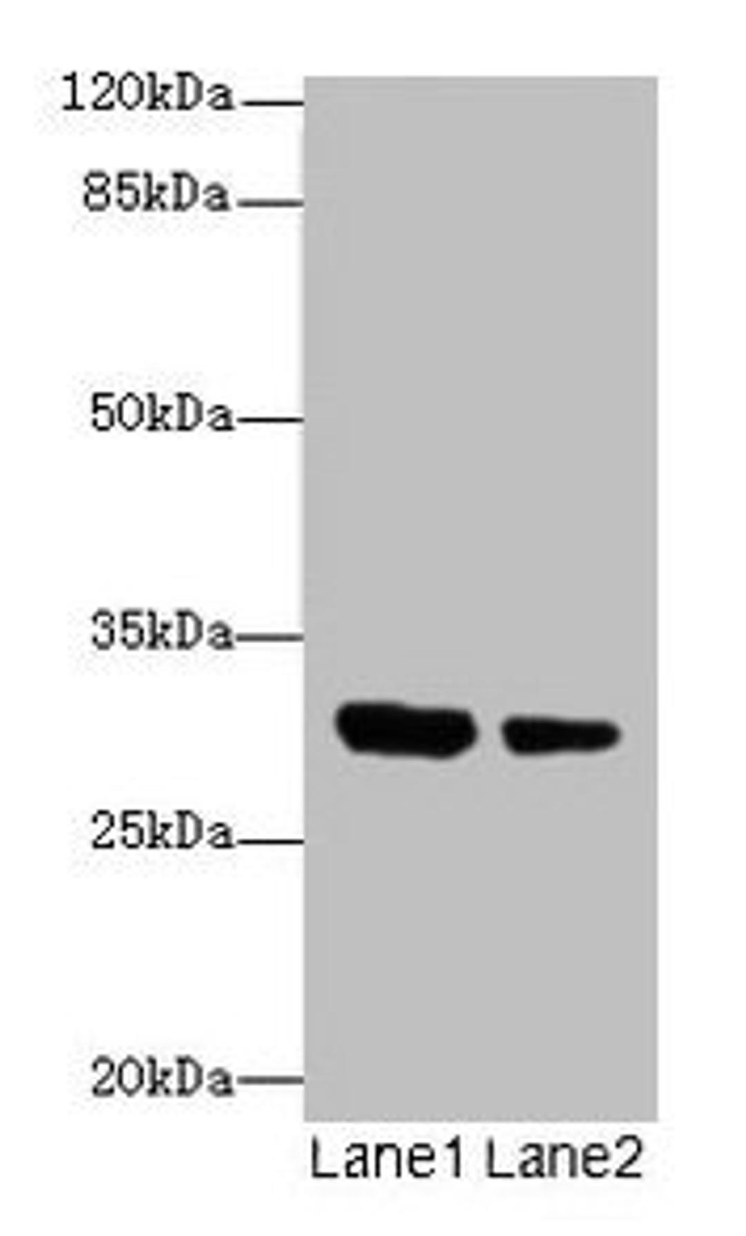 Western blot. All lanes: IL1A antibody at 6µg/ml. Lane 1: Jurkat whole cell lysate. Lane 2: Human placenta tissue. Secondary. Goat polyclonal to rabbit IgG at 1/10000 dilution. Predicted band size: 31 kDa. Observed band size: 31 kDa