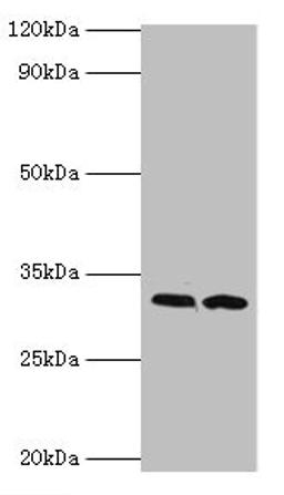 Western blot. All lanes: RDM1 antibody at 4ug/ml. Lane 1: PC-3 whole cell lysate. Lane 2: MCF-7 whole cell lysate. Secondary. Goat polyclonal to rabbit IgG at 1/10000 dilution. Predicted band size: 32, 30, 16, 14, 29, 26, 9, 13, 19, 27 kDa. Observed band size: 32 kDa. 