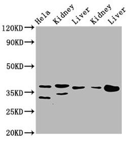 Western Blot. Positive WB detected in: Hela whole cell lysate, Rat kidney tissue, Rat liver tissue, Mouse kidney tissue, Mouse liver tissue. All lanes: PPA2 antibody at 3.1µg/ml. Secondary. Goat polyclonal to rabbit IgG at 1/50000 dilution. Predicted band size: 38, 40, 35, 19, 26 kDa. Observed band size: 38 kDa