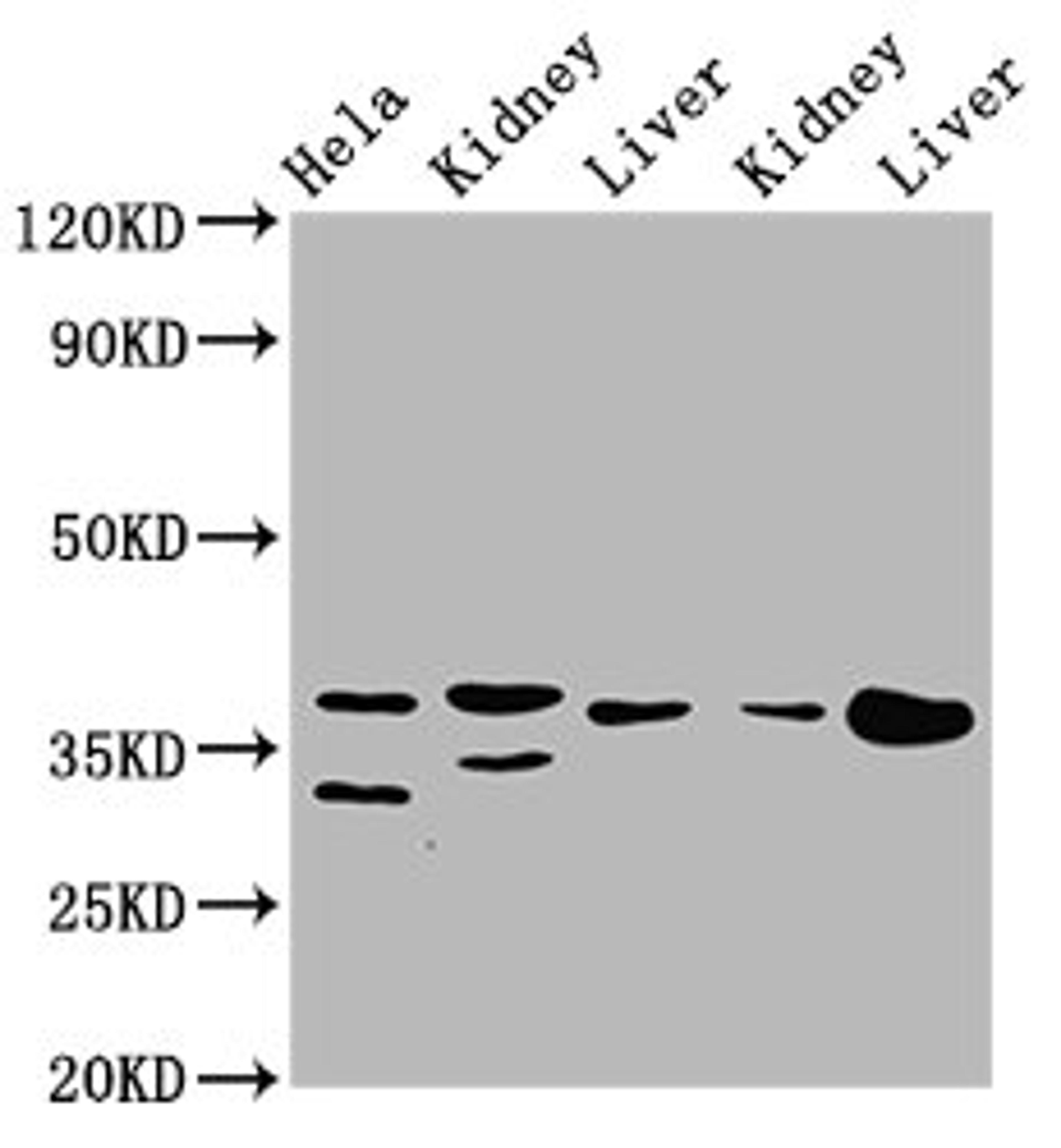Western Blot. Positive WB detected in: Hela whole cell lysate, Rat kidney tissue, Rat liver tissue, Mouse kidney tissue, Mouse liver tissue. All lanes: PPA2 antibody at 3.1µg/ml. Secondary. Goat polyclonal to rabbit IgG at 1/50000 dilution. Predicted band size: 38, 40, 35, 19, 26 kDa. Observed band size: 38 kDa