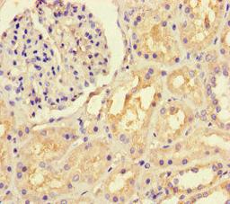 Immunohistochemistry of paraffin-embedded human kidney tissue using CSB-PA02049A0Rb at dilution of 1:100