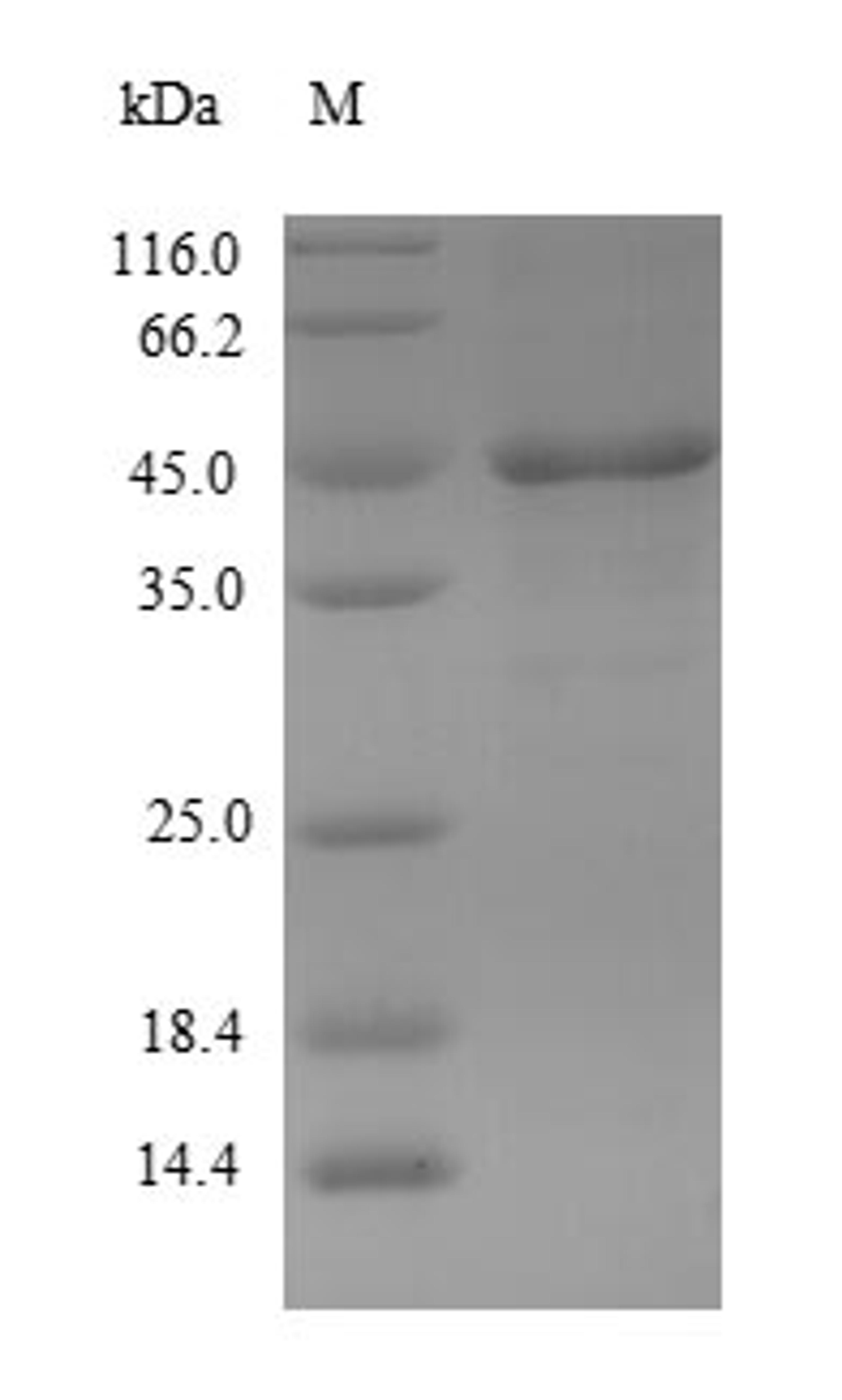 (Tris-Glycine gel) Discontinuous SDS-PAGE (reduced) with 5% enrichment gel and 15% separation gel.