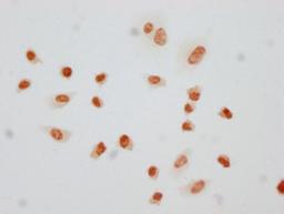 Immunocytochemistry analysis of CSB-PA010380PA145phHU diluted at 1:10 and staining in Hela cells(treated with 50nM Calyculin A for 30min) performed on a Leica BondTM system. The cells were fixed in 4% formaldehyde, permeabilized using 0.2% Triton X-100 and blocked with 10% normal goat serum 30min at RT. Then primary antibody (1% BSA) was incubated at 4°C overnight. The primary is detected by a biotinylated secondary antibody and visualized using an HRP conjugated SP system.