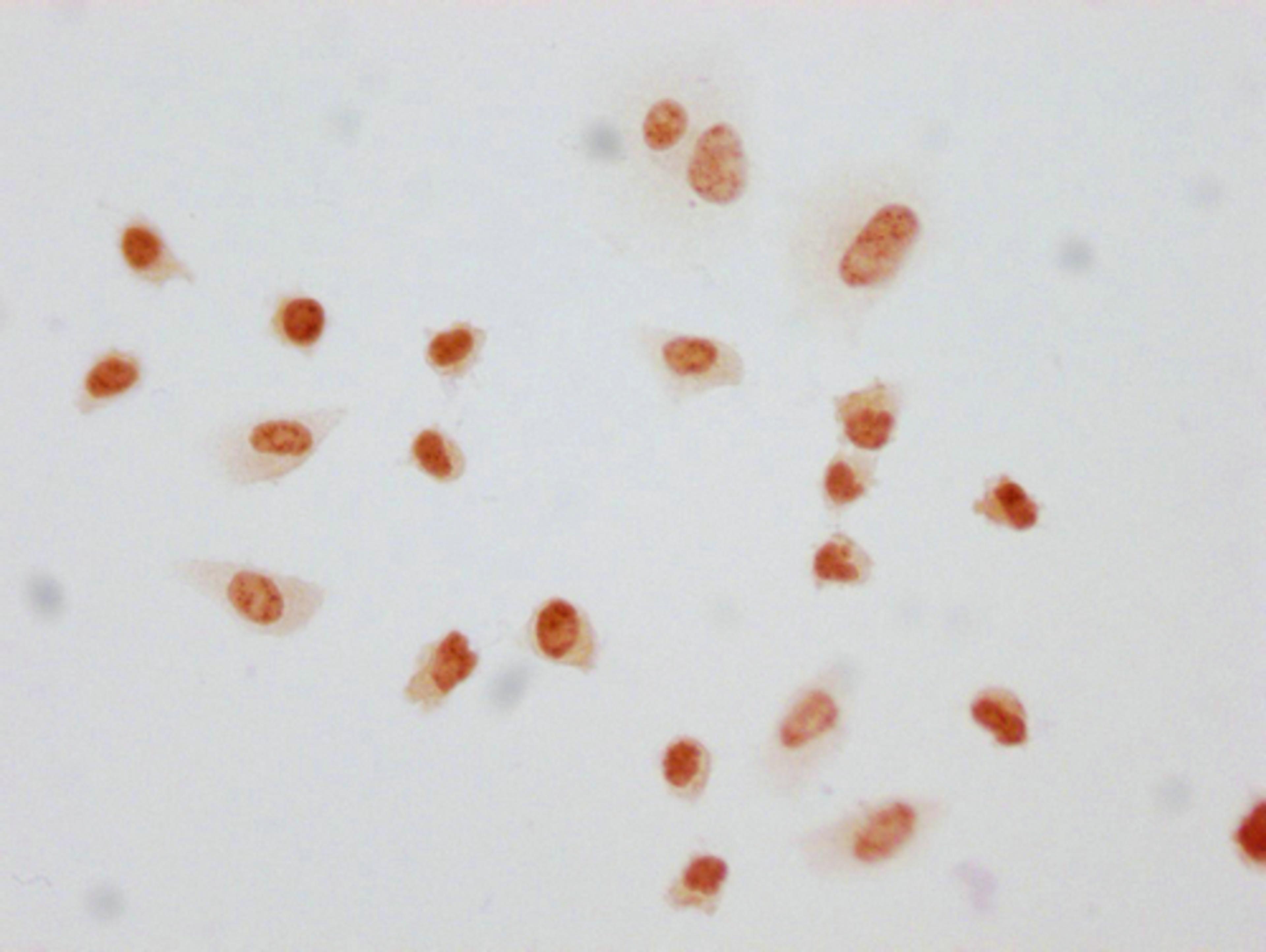 Immunocytochemistry analysis of CSB-PA010380PA145phHU diluted at 1:10 and staining in Hela cells(treated with 50nM Calyculin A for 30min) performed on a Leica BondTM system. The cells were fixed in 4% formaldehyde, permeabilized using 0.2% Triton X-100 and blocked with 10% normal goat serum 30min at RT. Then primary antibody (1% BSA) was incubated at 4°C overnight. The primary is detected by a biotinylated secondary antibody and visualized using an HRP conjugated SP system.