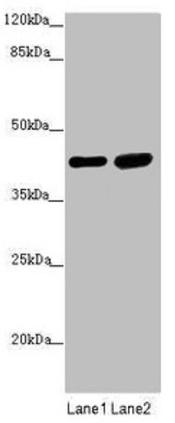 Western blot. All lanes: SERPINB6 antibody at 0.4µg/ml. Lane 1: Human placenta tissue. Lane 2: HepG2 whole cell lysate. Secondary. Goat polyclonal to rabbit IgG at 1/10000 dilution. Predicted band size: 43 kDa. Observed band size: 43 kDa