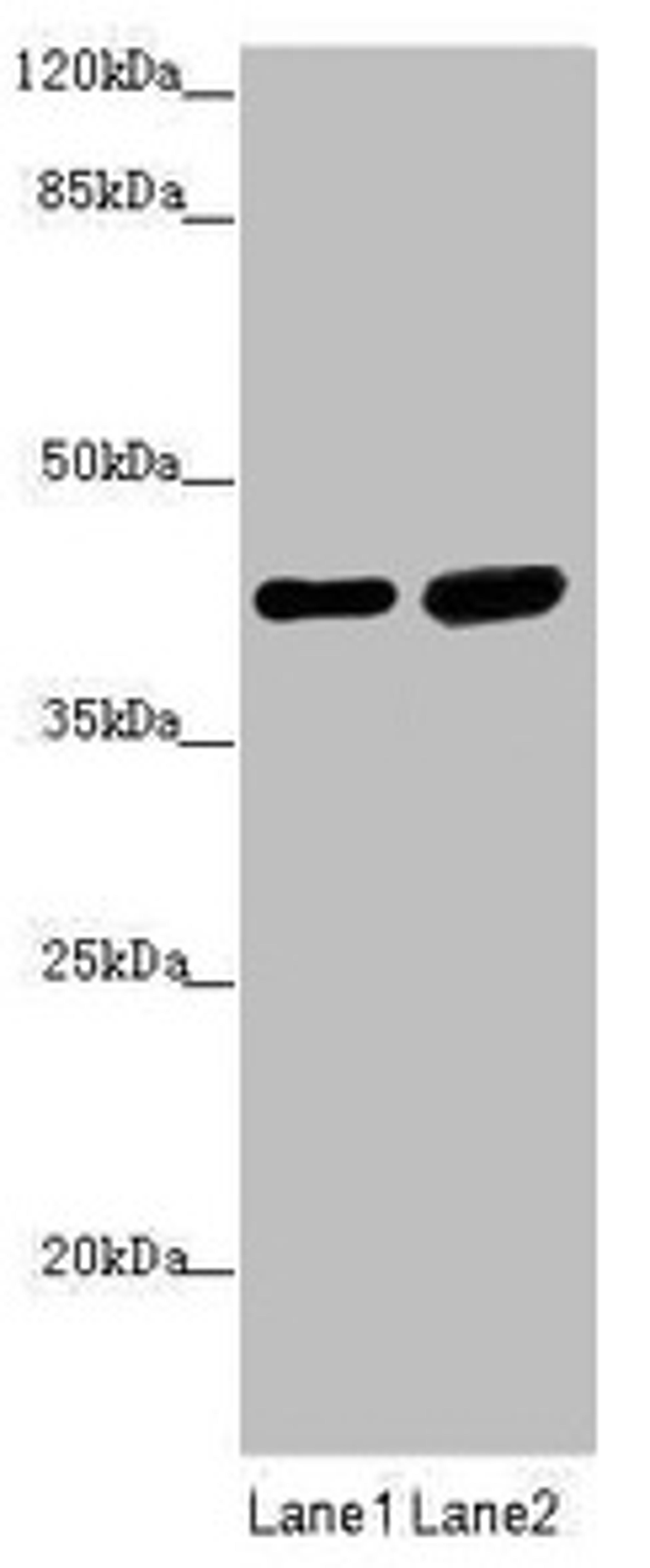 Western blot. All lanes: SERPINB6 antibody at 0.4µg/ml. Lane 1: Human placenta tissue. Lane 2: HepG2 whole cell lysate. Secondary. Goat polyclonal to rabbit IgG at 1/10000 dilution. Predicted band size: 43 kDa. Observed band size: 43 kDa