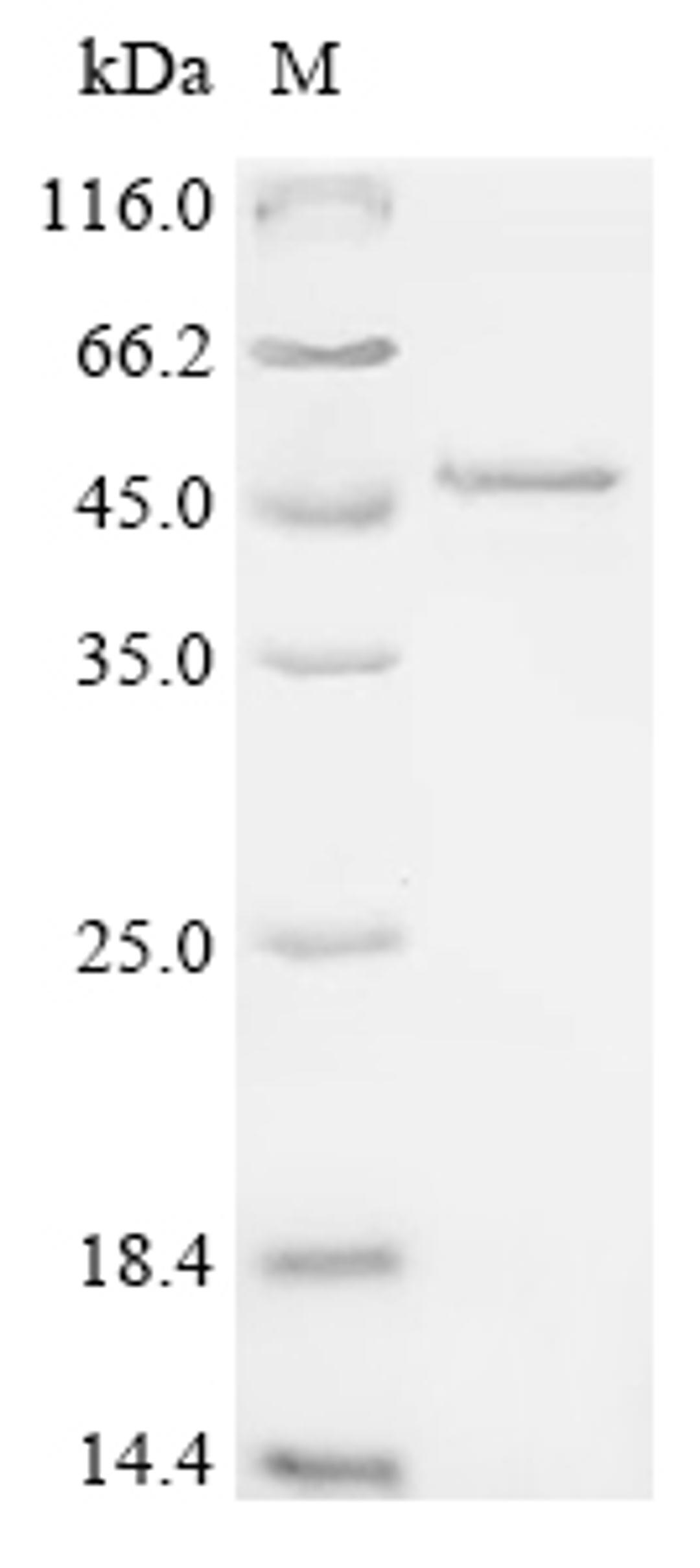 (Tris-Glycine gel) Discontinuous SDS-PAGE (reduced) with 5% enrichment gel and 15% separation gel.