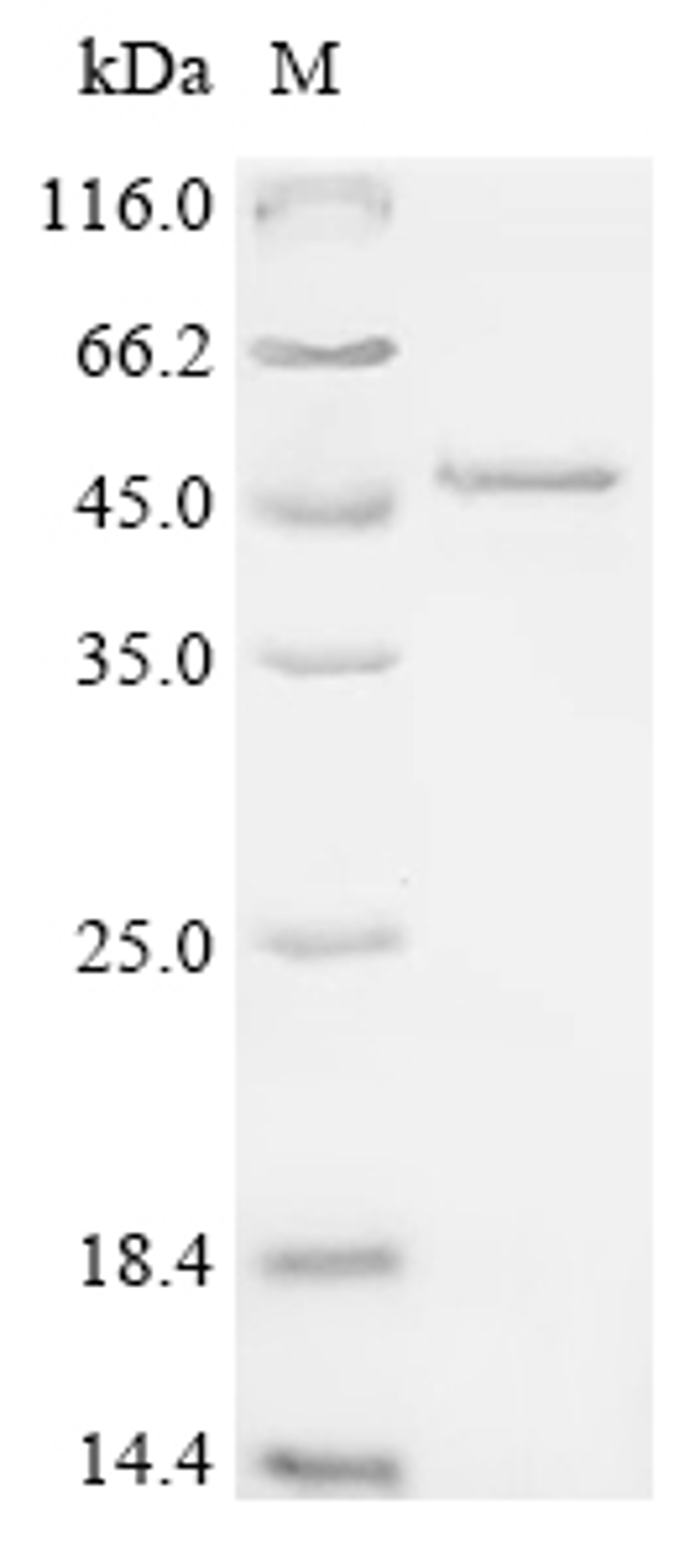 (Tris-Glycine gel) Discontinuous SDS-PAGE (reduced) with 5% enrichment gel and 15% separation gel.