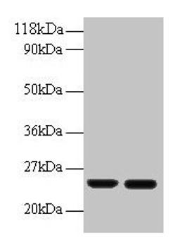 Western blot. All lanes: RBP4 antibody at 2µg/ml. Lane 1: Human positive serum at 1: 10. Lane 2: Human positive serum at 1: 100. Secondary. Goat polyclonal to rabbit IgG at 1/50000 dilution. Predicted band size: 24 kDa. Observed band size: 24 kDa