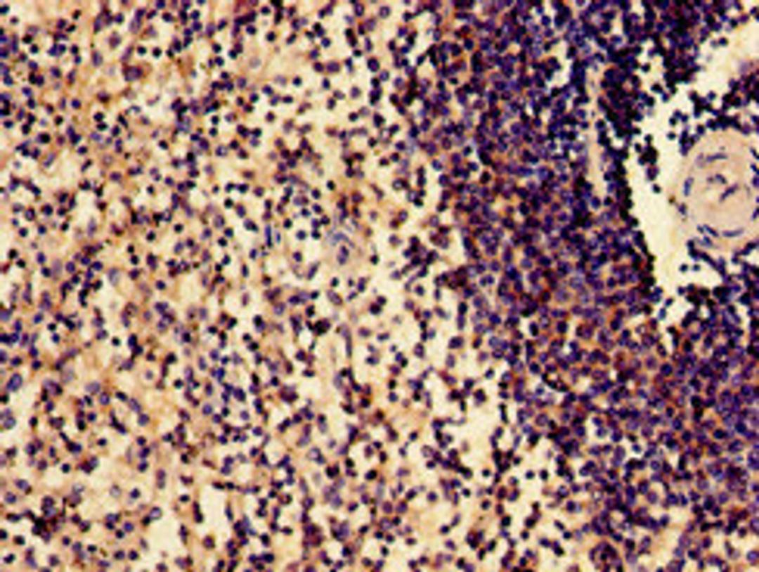 Immunohistochemistry of paraffin-embedded human spleen tissue using CSB-PA614403LA01HU at dilution of 1:100
