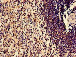 Immunohistochemistry of paraffin-embedded human spleen tissue using CSB-PA614403LA01HU at dilution of 1:100