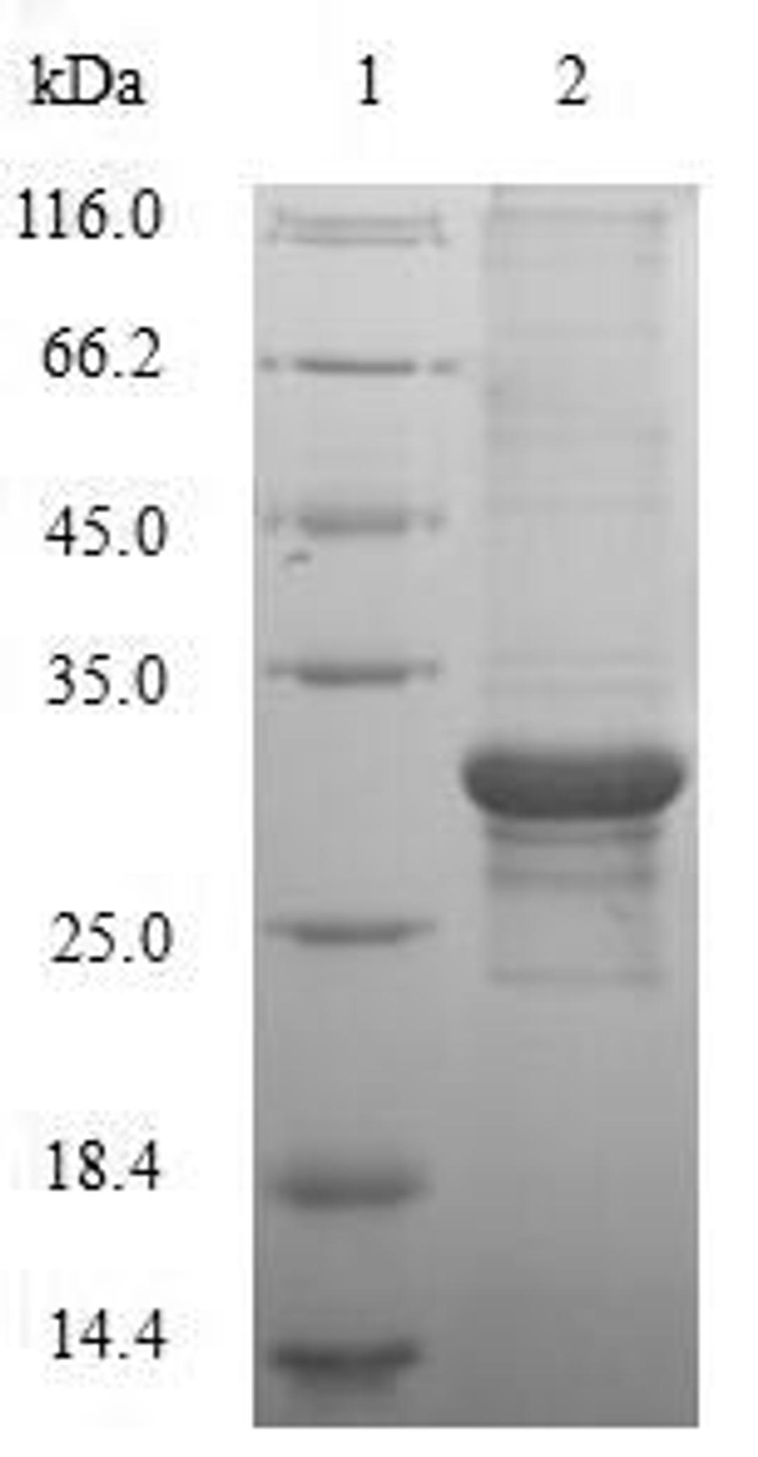 (Tris-Glycine gel) Discontinuous SDS-PAGE (reduced) with 5% enrichment gel and 15% separation gel.
