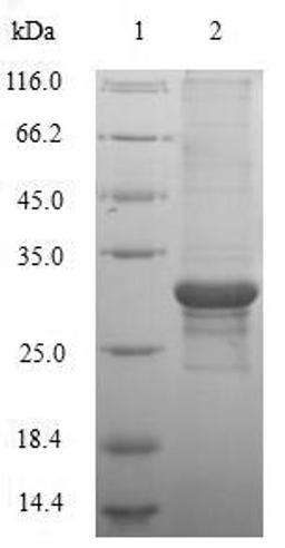 (Tris-Glycine gel) Discontinuous SDS-PAGE (reduced) with 5% enrichment gel and 15% separation gel.