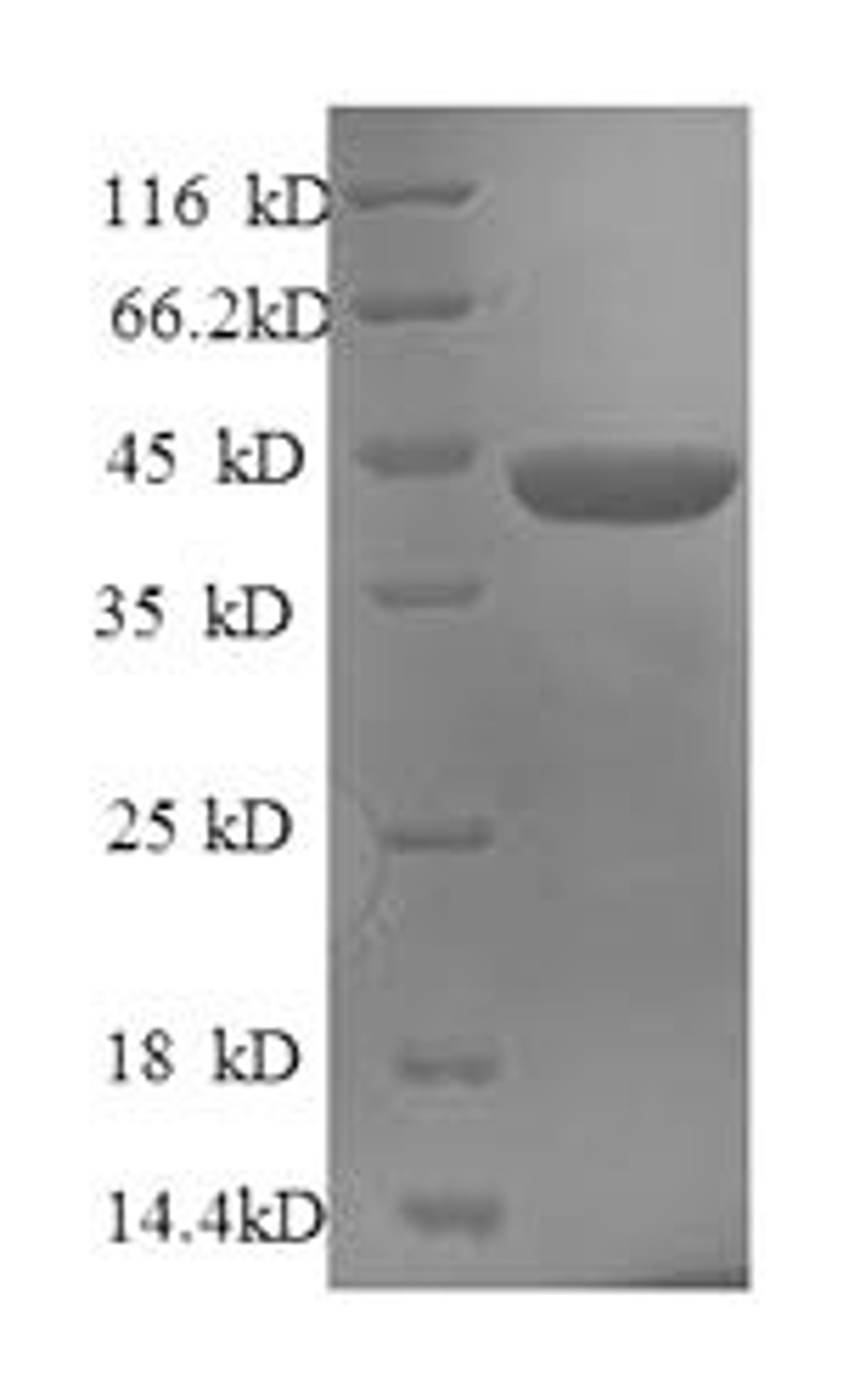 (Tris-Glycine gel) Discontinuous SDS-PAGE (reduced) with 5% enrichment gel and 15% separation gel.