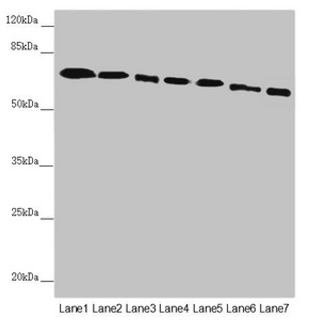 Western blot. All lanes: DYNC1I1 antibody at 2.52µg/ml. Lane 1: Mouse brain tissue. Lane 2: Mouse gonadal tissue. Lane 3: K562 whole cell lysate. Lane 4: HL60 whole cell lysate. Lane 5: Mouse lung tissue. Lane 6: Mouse skeletal muscle tissue. Lane 7: Mouse stomach tissue. Secondary. Goat polyclonal to rabbit IgG at 1/10000 dilution. Predicted band size: 73, 71, 69, 68 kDa. Observed band size: 73 kDa