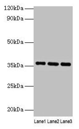 Western blot. All lanes: Apoe antibody at 2µg/ml. Lane 1: Mouse liver tissue. Lane 2: Mouse brain tissue. Lane 3: Mouse lung tissue. Secondary. Goat polyclonal to rabbit IgG at 1/10000 dilution. Predicted band size: 36 kDa. Observed band size: 36 kDa